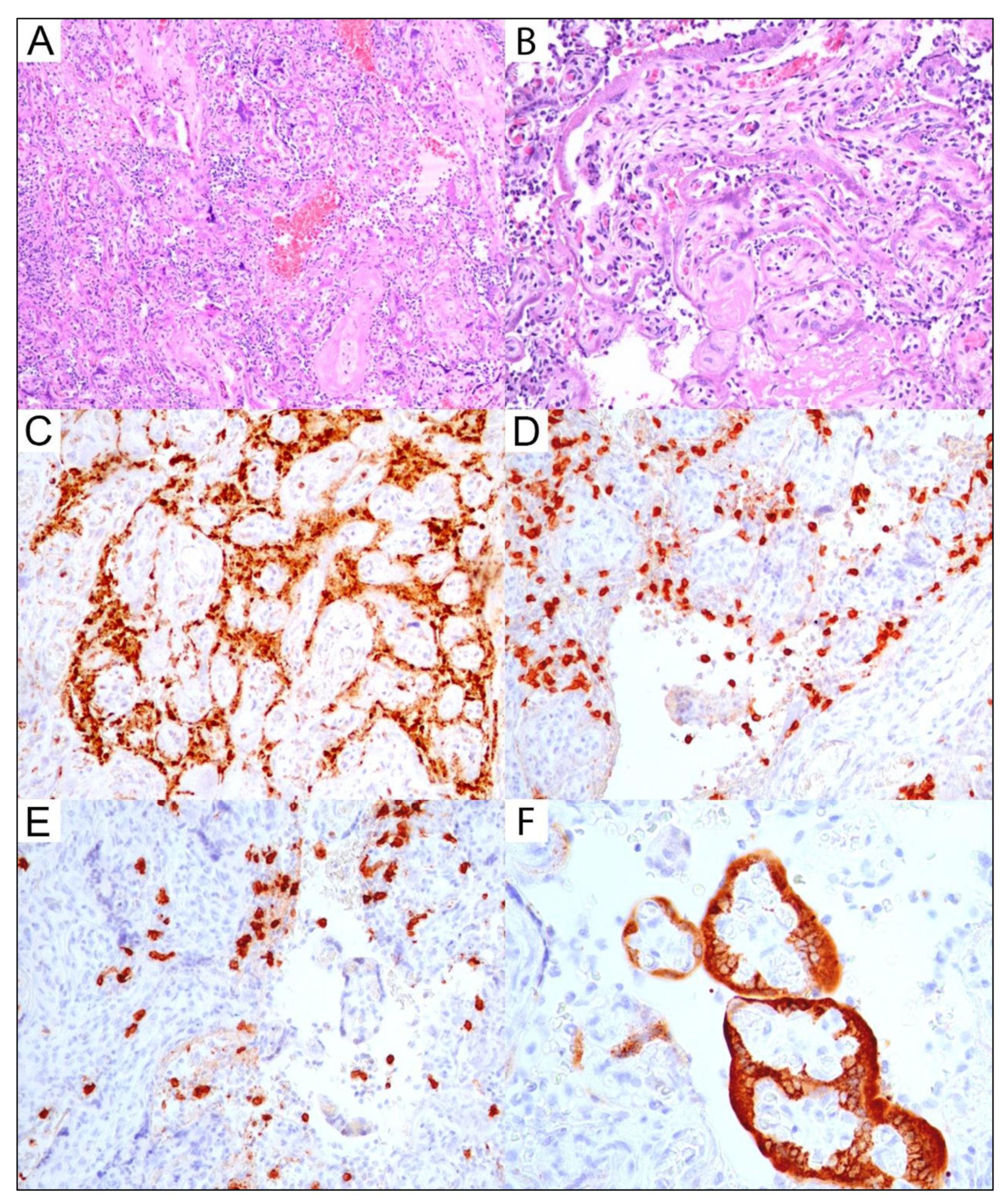 Viruses 14 02043 g002 550