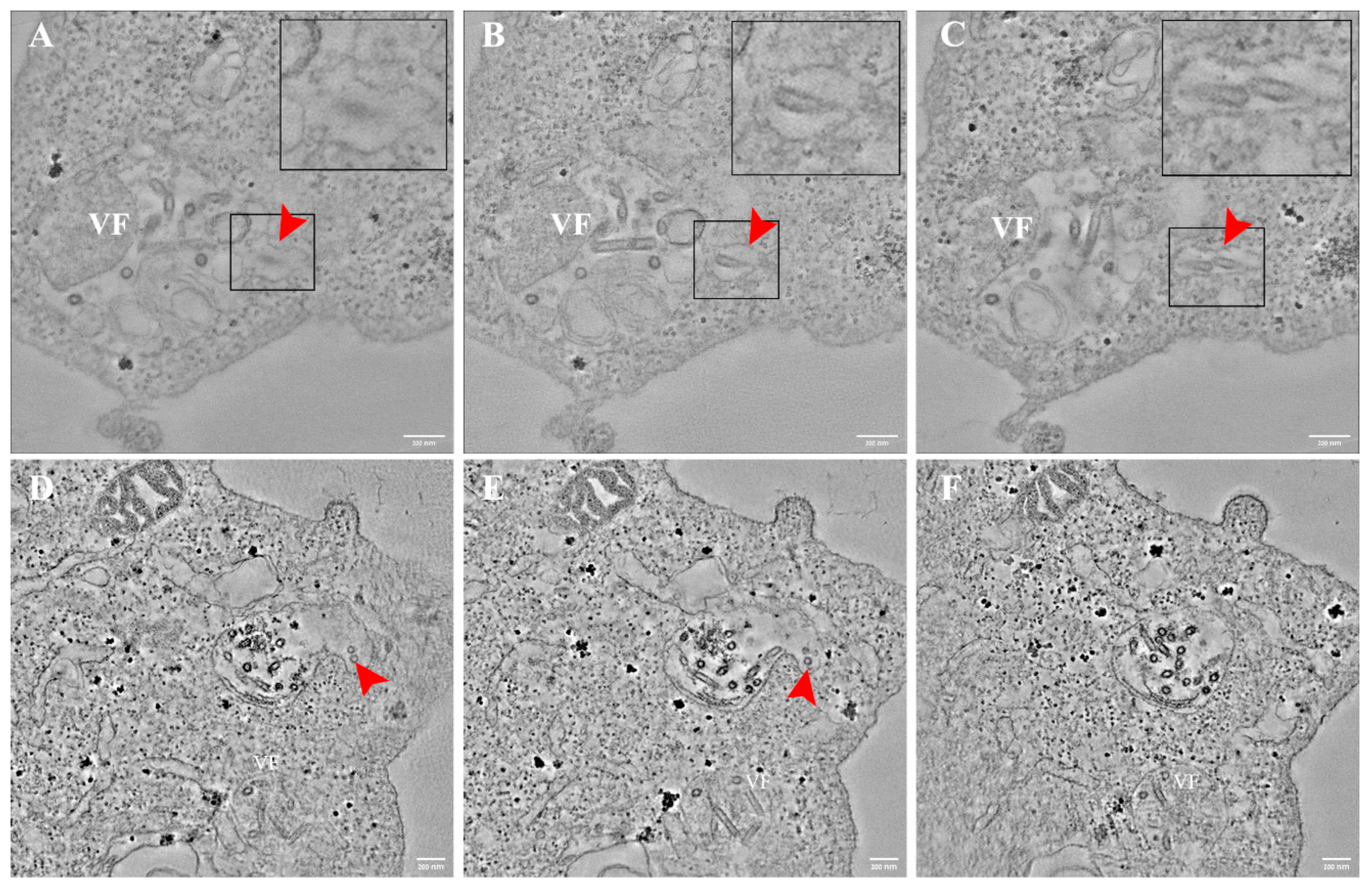 Viruses 14 02828 g007 Viruses 14 02828 g007