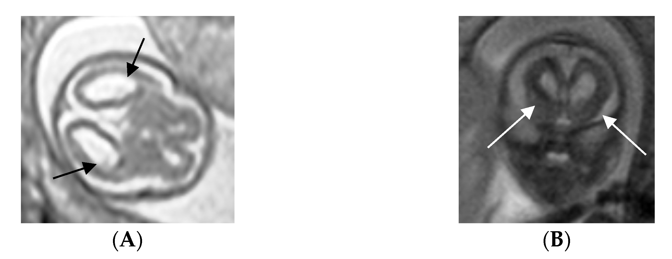 Viruses 15 00112 g002 Viruses 15 00112 g002