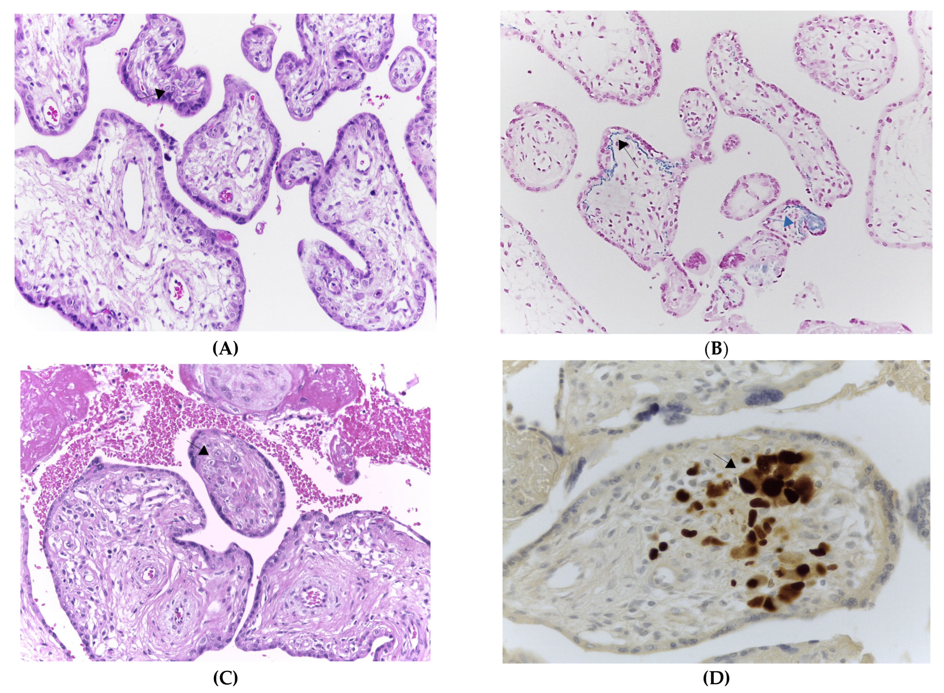Viruses 15 00112 g003 Viruses 15 00112 g003