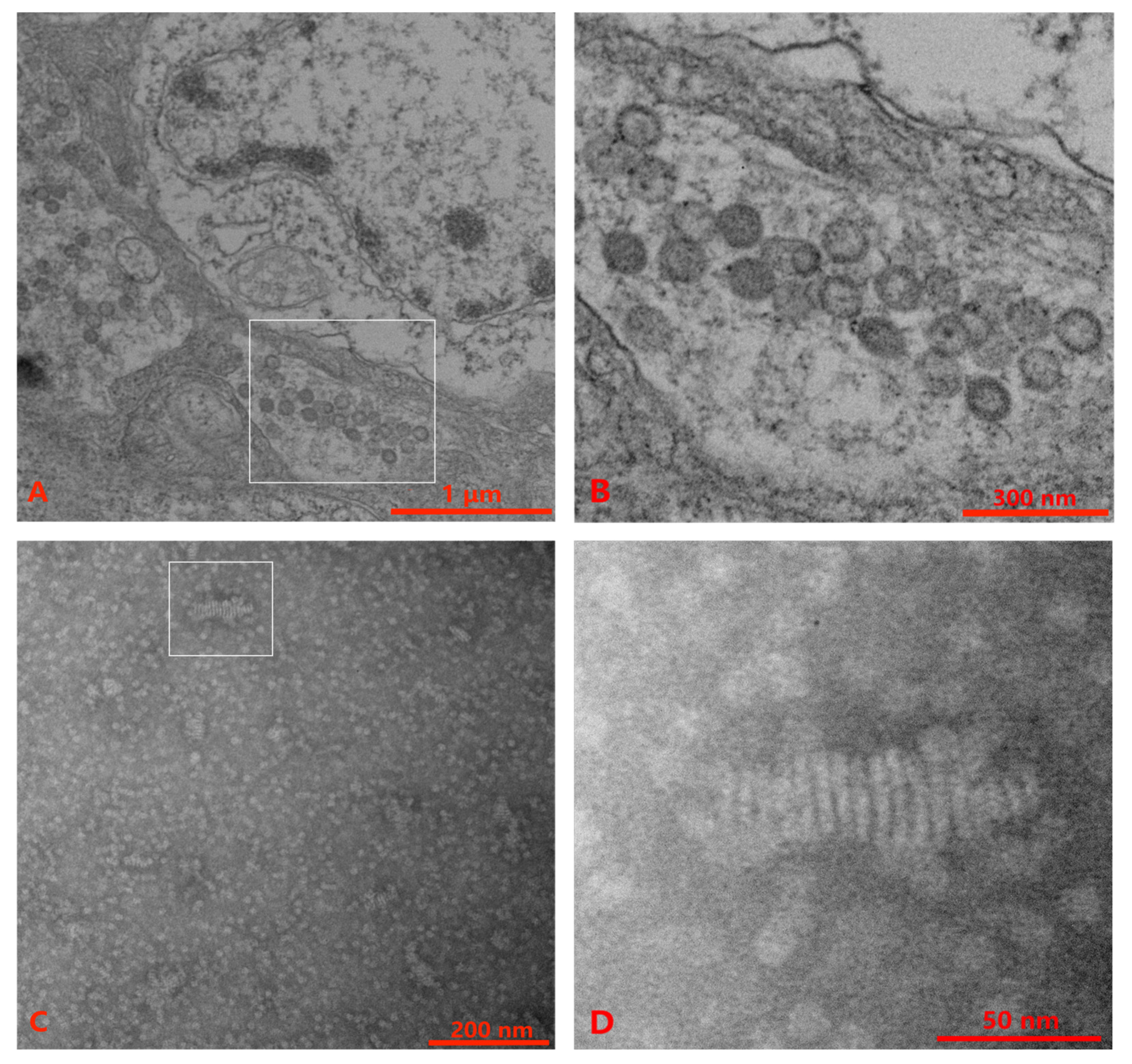 Viruses 15 00361 g001 Viruses 15 00361 g001