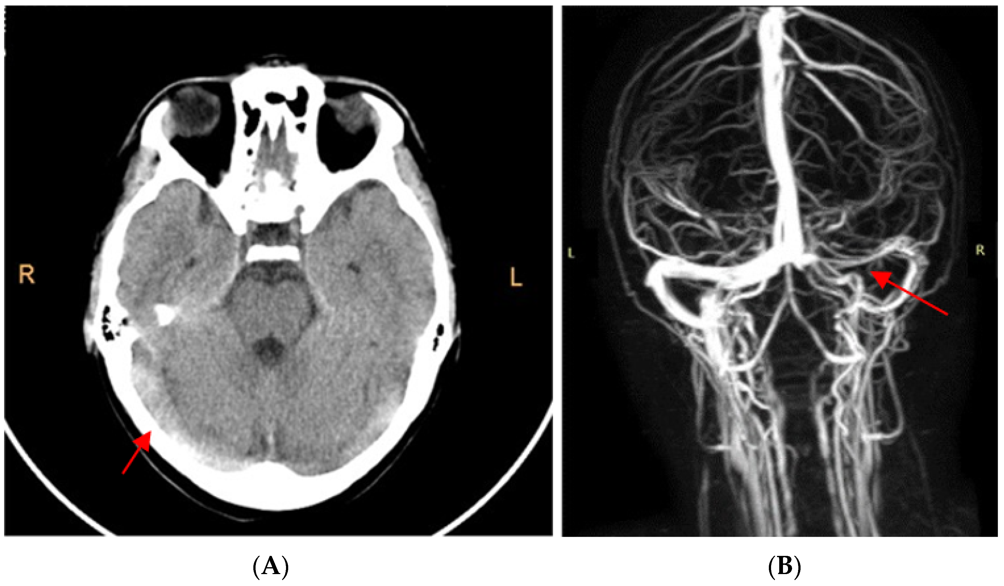 Viruses 15 00405 g001 Viruses 15 00405 g001