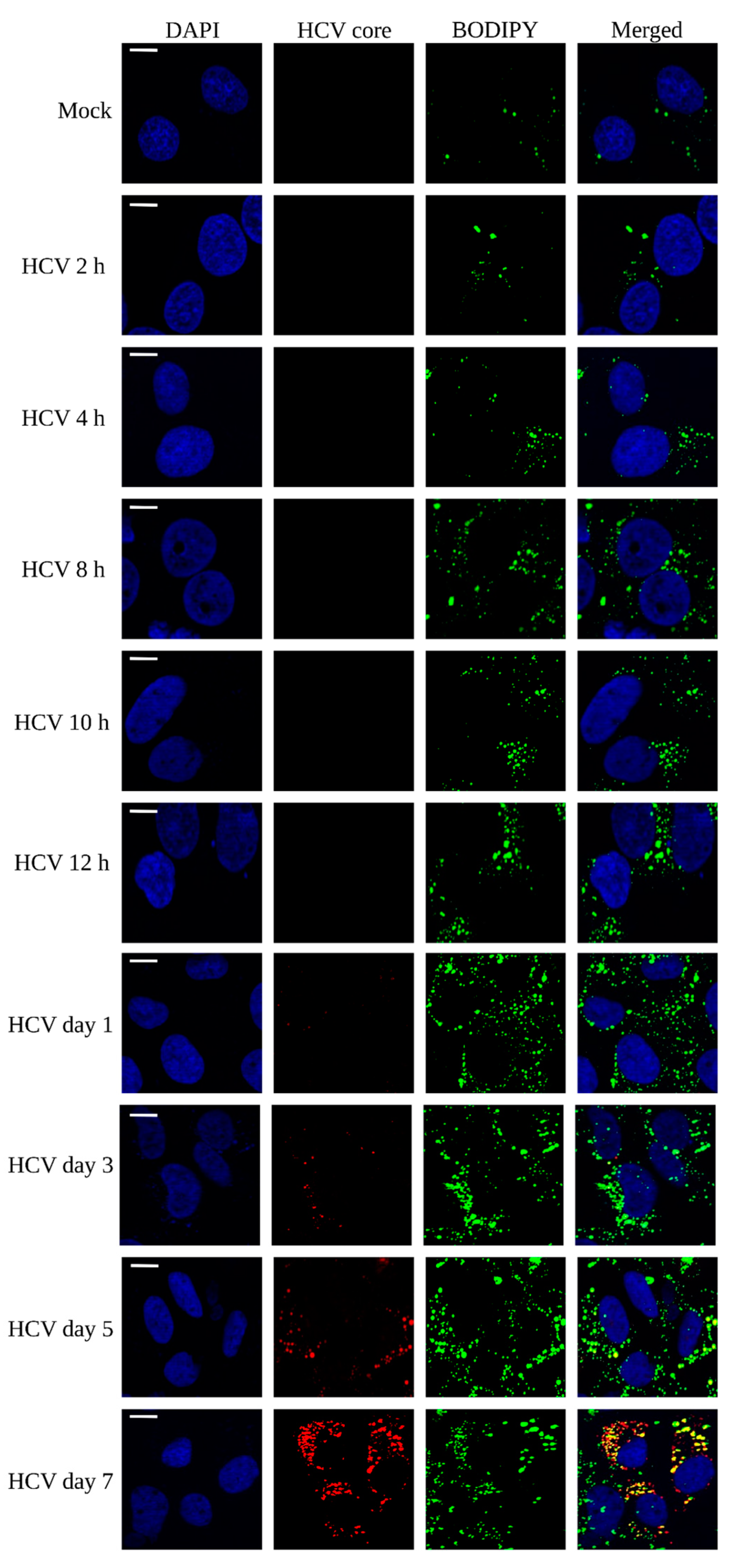 Viruses 15 00464 g002 Viruses 15 00464 g002
