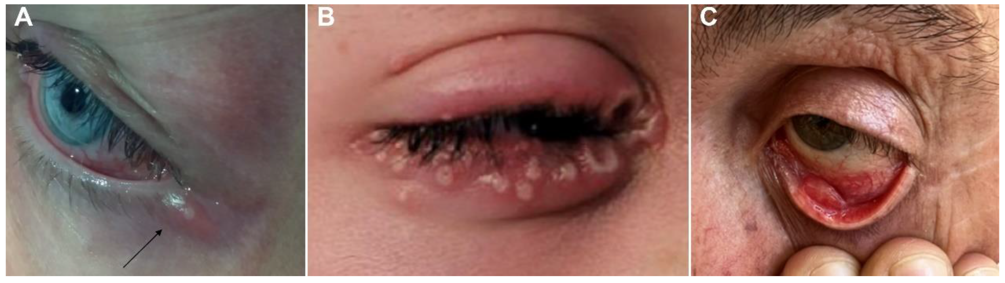 Viruses 15 00616 g001 Viruses 15 00616 g001