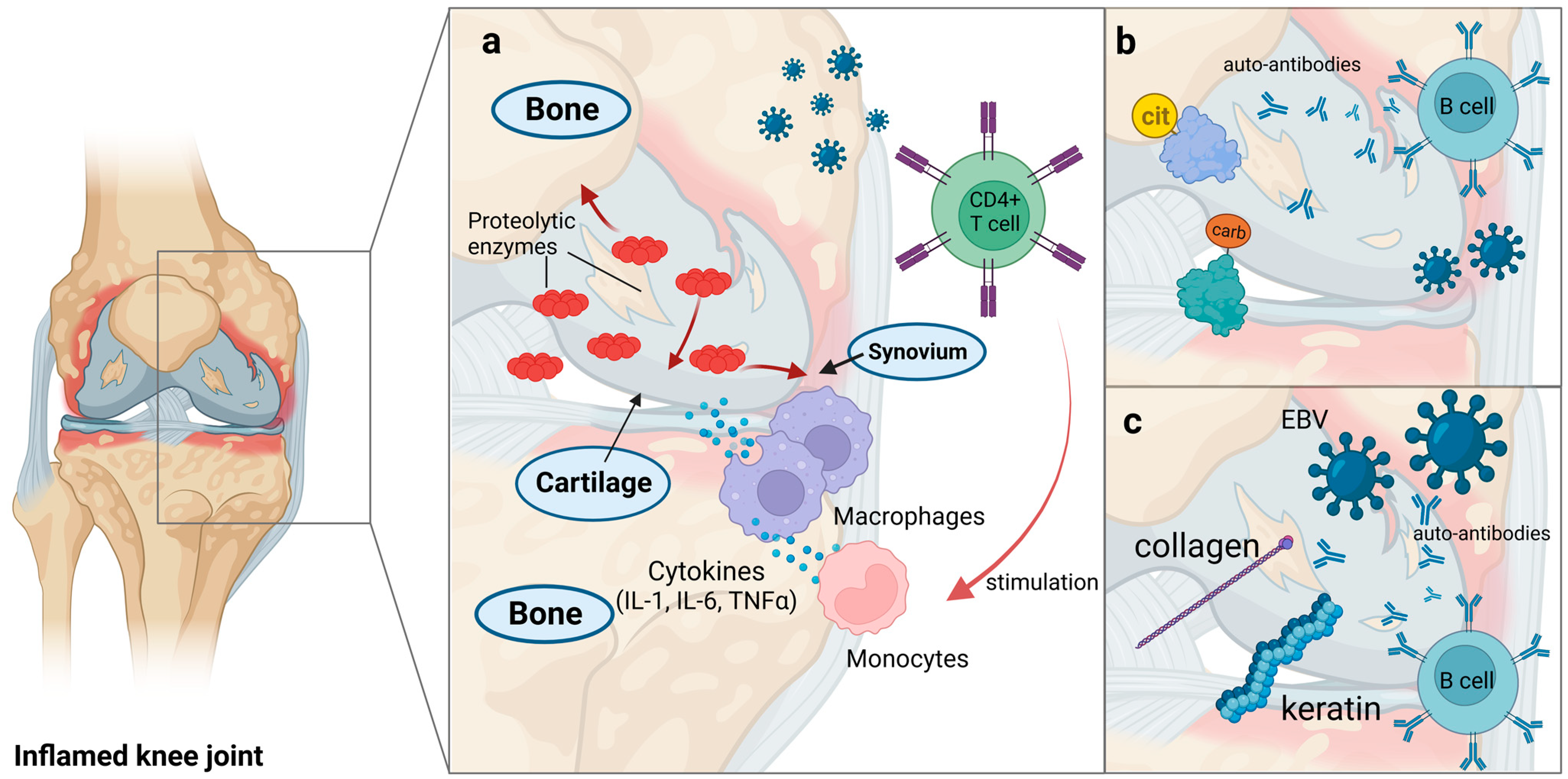信頼も厚い The Role of Viral Infections in the Onset of Autoimmune Diseases その他