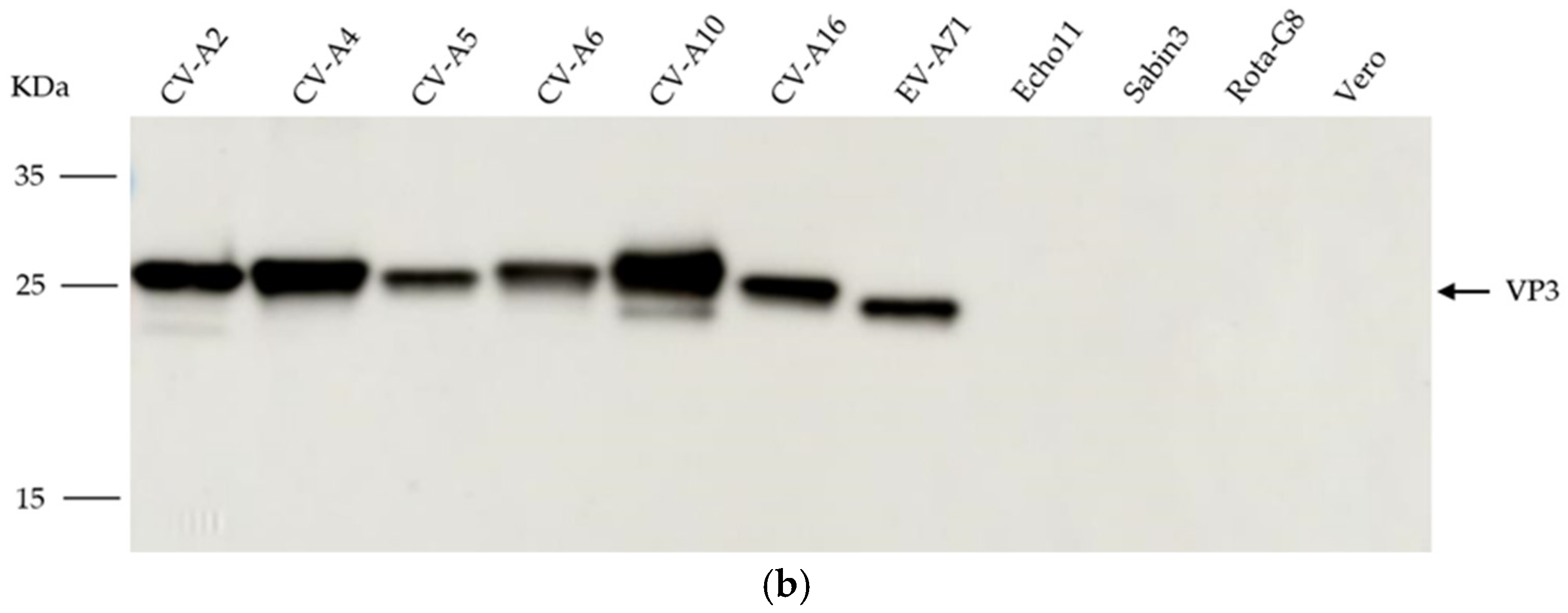 Viruses 15 01028 g002b Viruses 15 01028 g002b