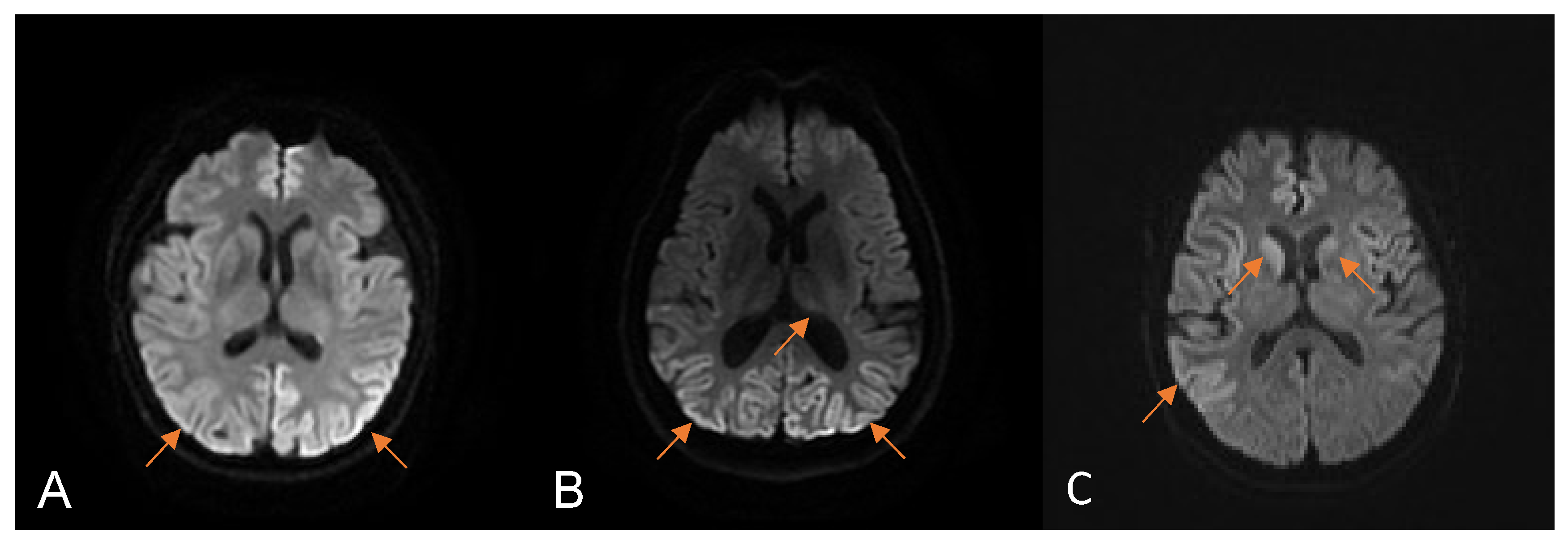Viruses 15 01092 g002 Viruses 15 01092 g002