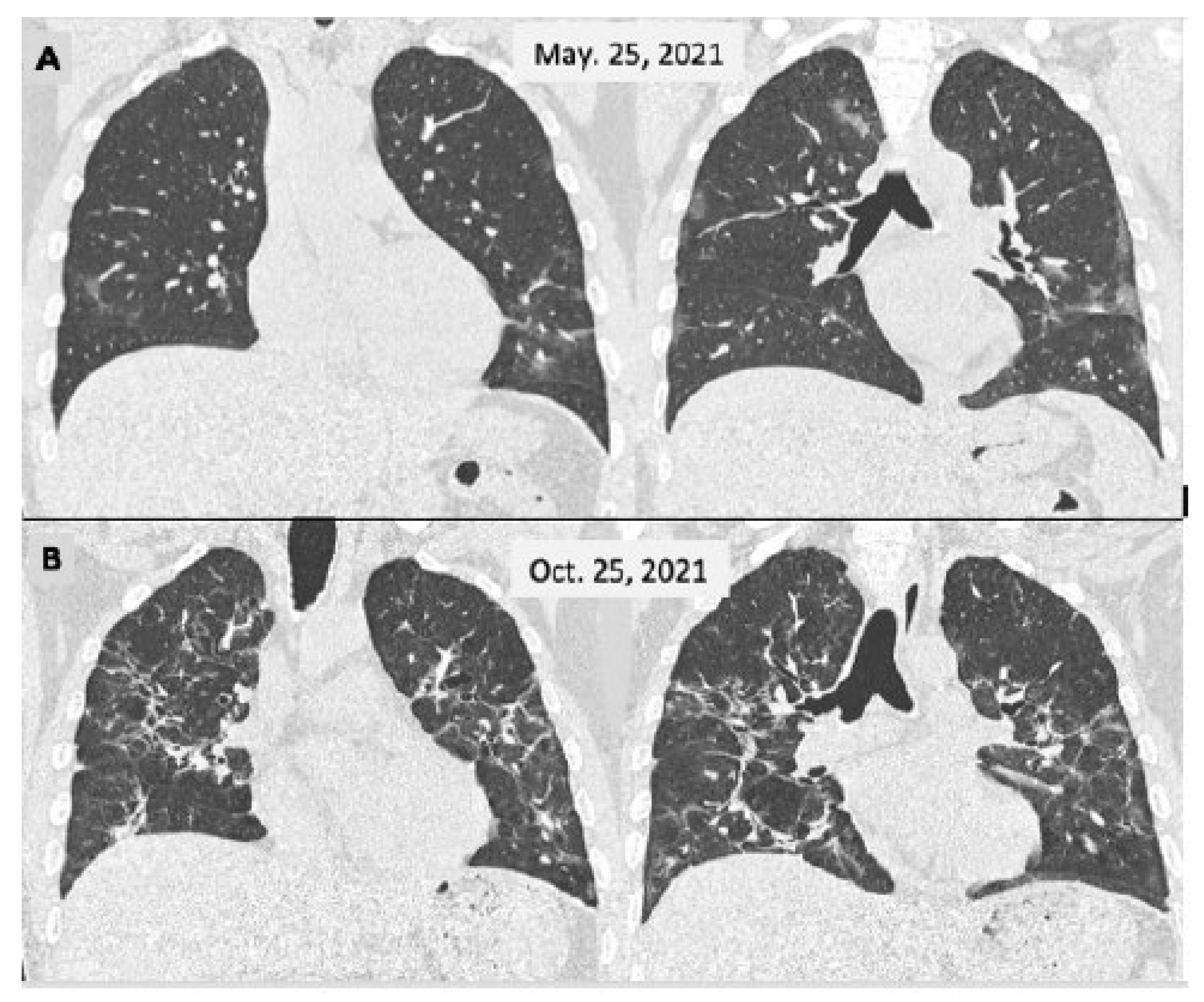 Viruses 15 01173 g002 Viruses 15 01173 g002