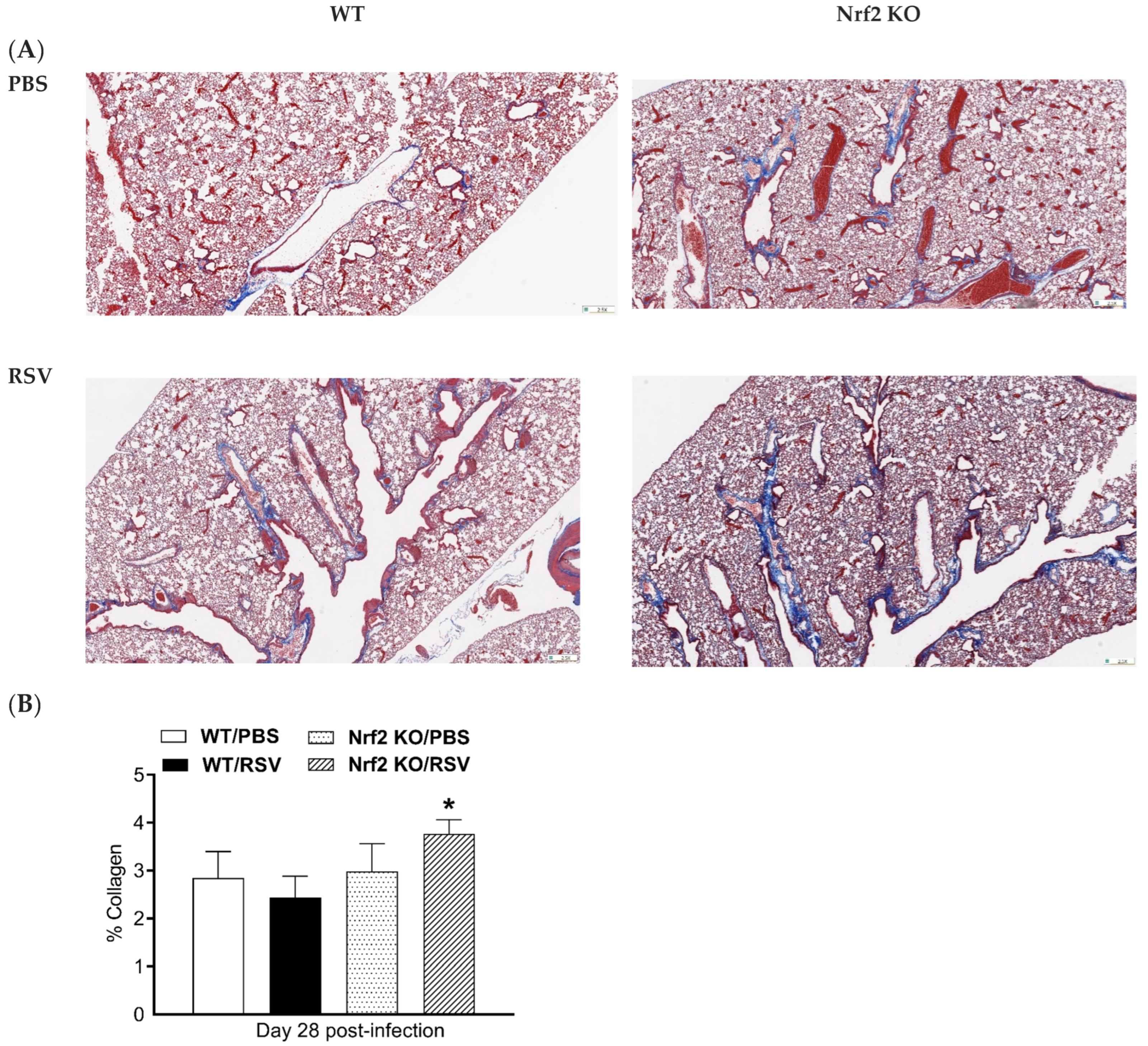 Micro-CT Features of Lung Consolidation, Collagen Deposition