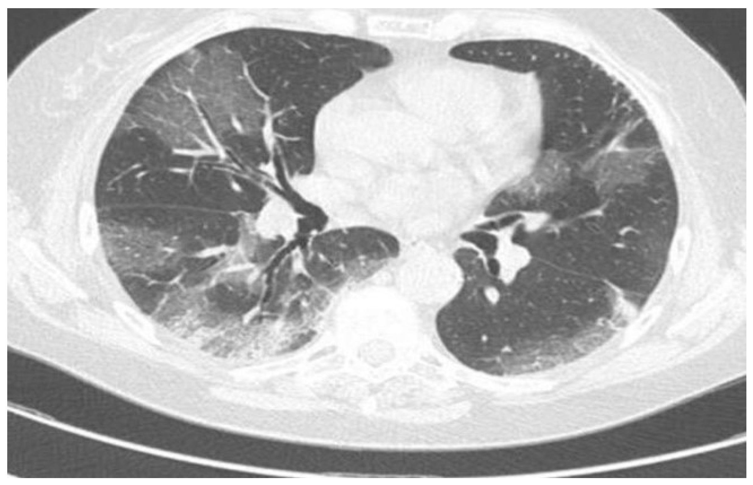 Viruses 15 01235 g001