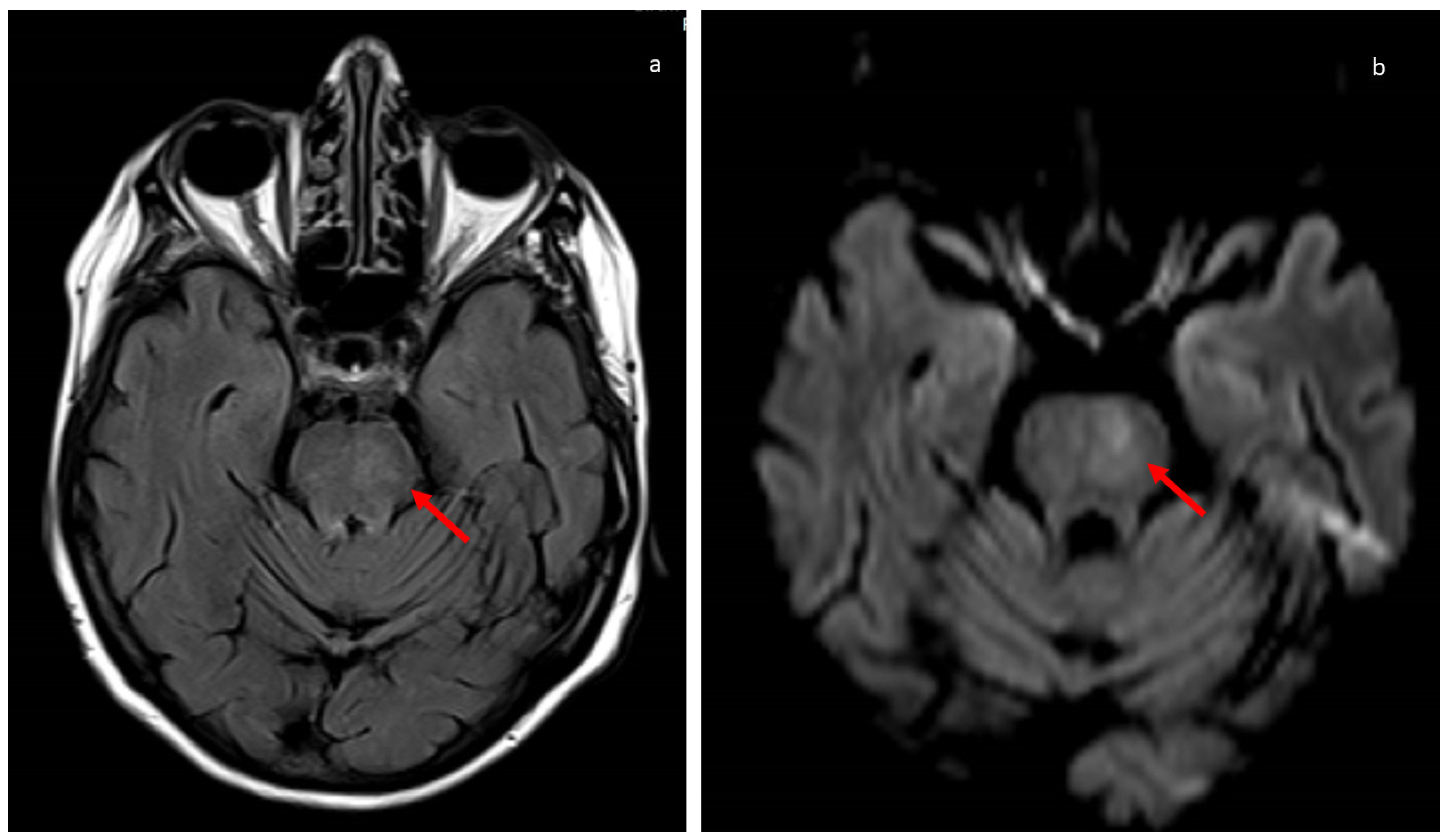 Viruses 15 01235 g002