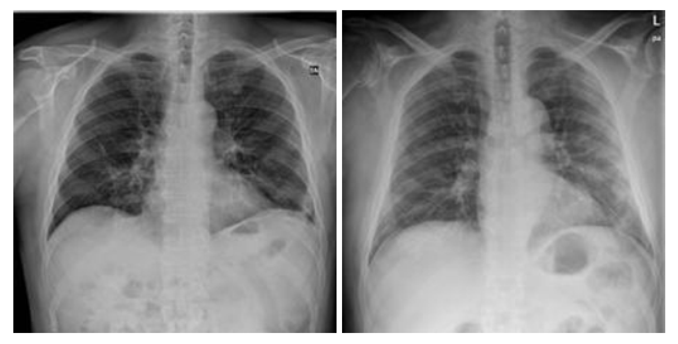 Viruses 15 01327 g004 Viruses 15 01327 g004