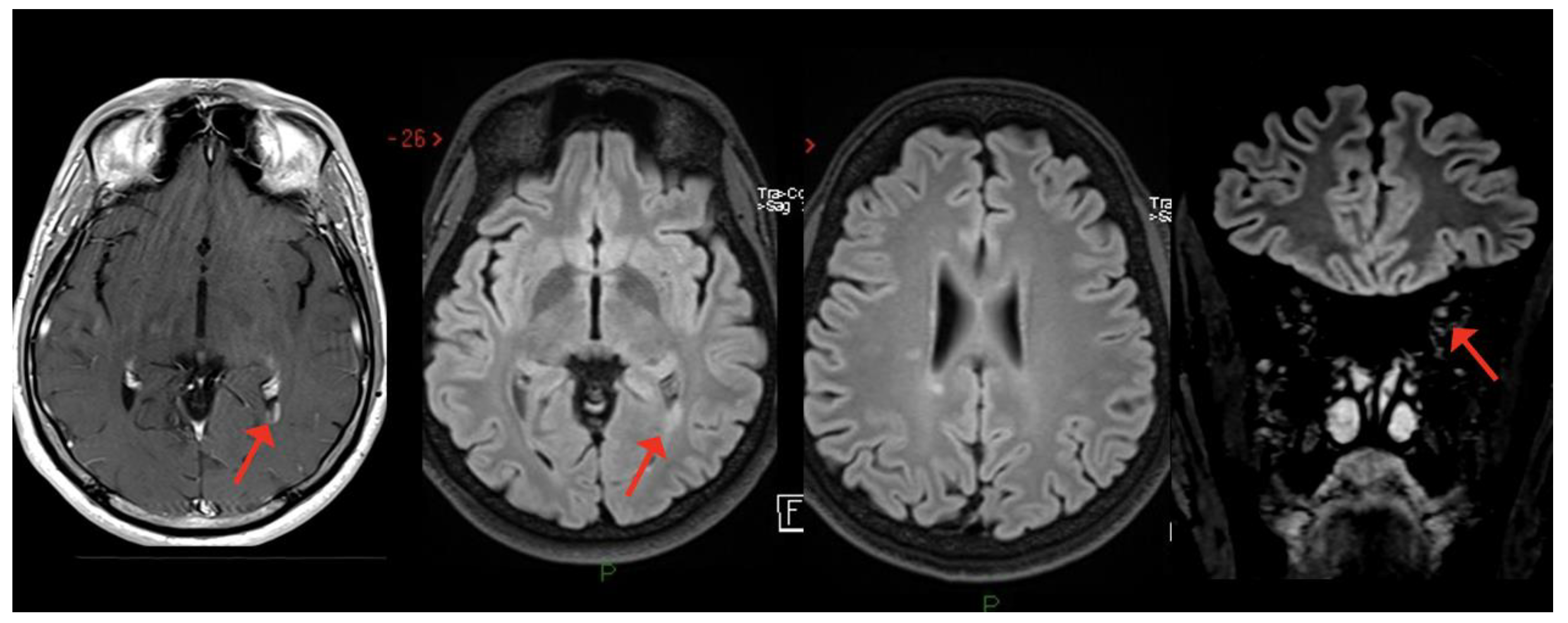 Viruses 15 01569 g006 Viruses 15 01569 g006