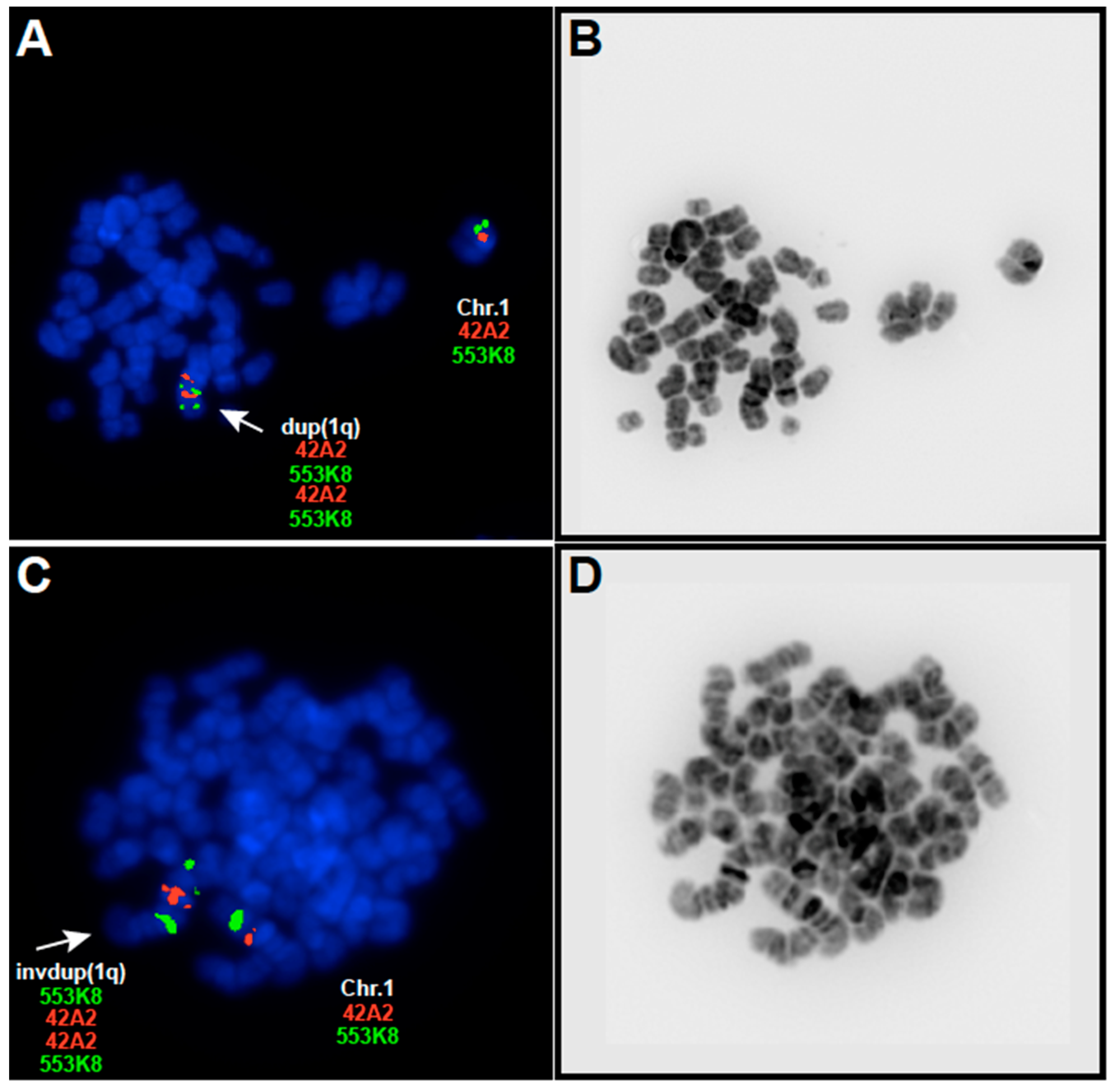 Viruses | Free Full-Text | EBV and 1q Gains Affect Gene and miRNA 