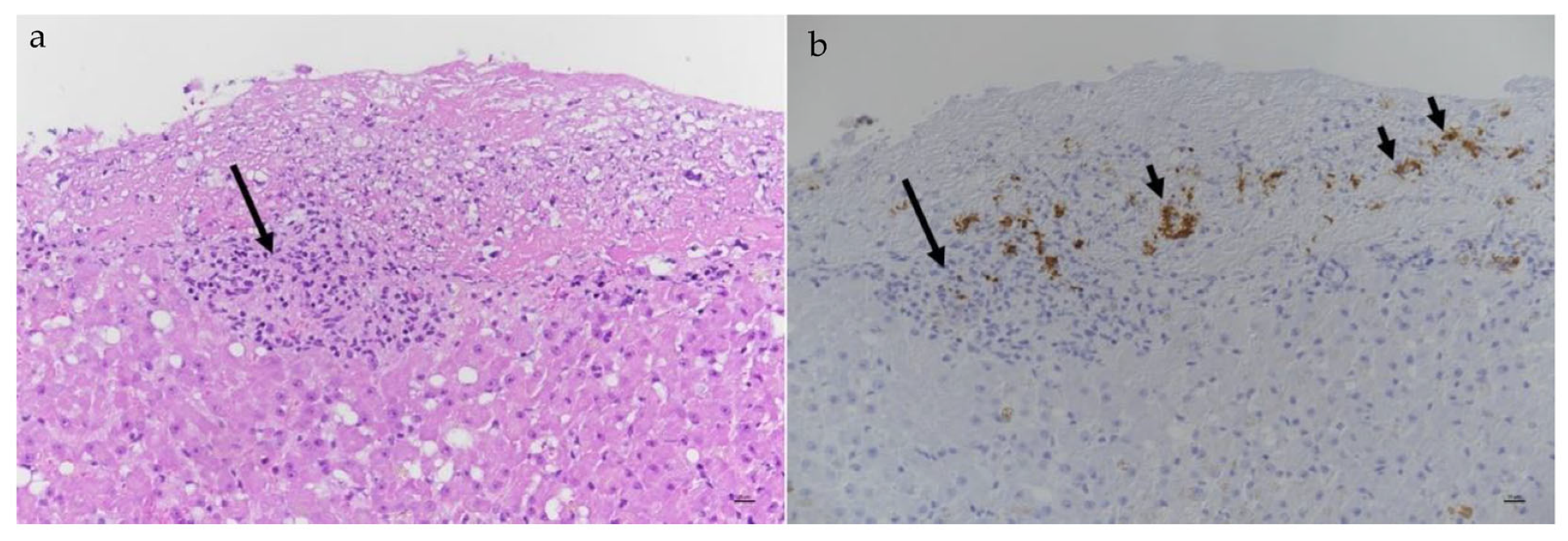 Viruses 15 01847 g023 Viruses 15 01847 g023