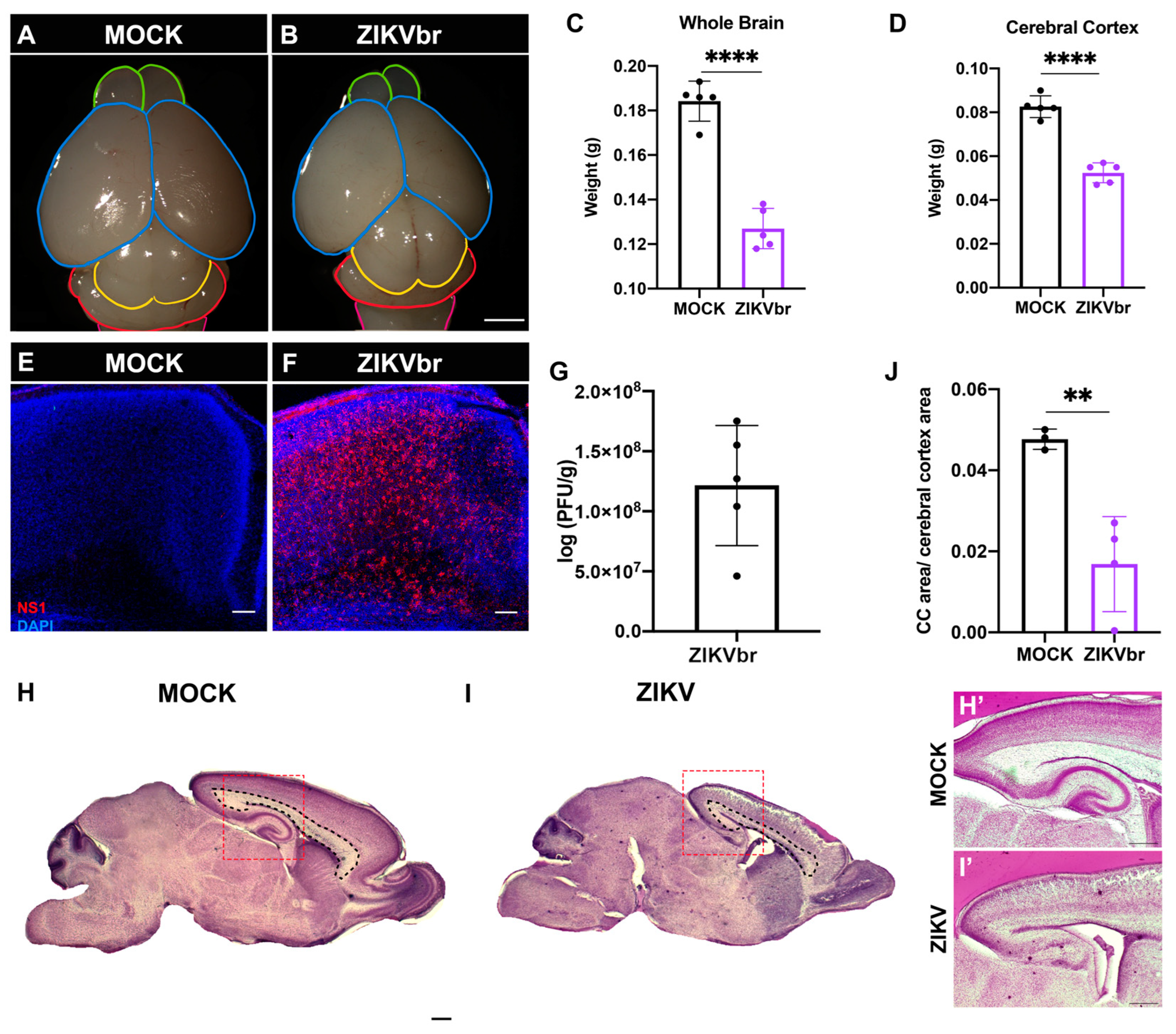 Viruses | Free Full-Text | Congenital Zika Virus Infection Impairs