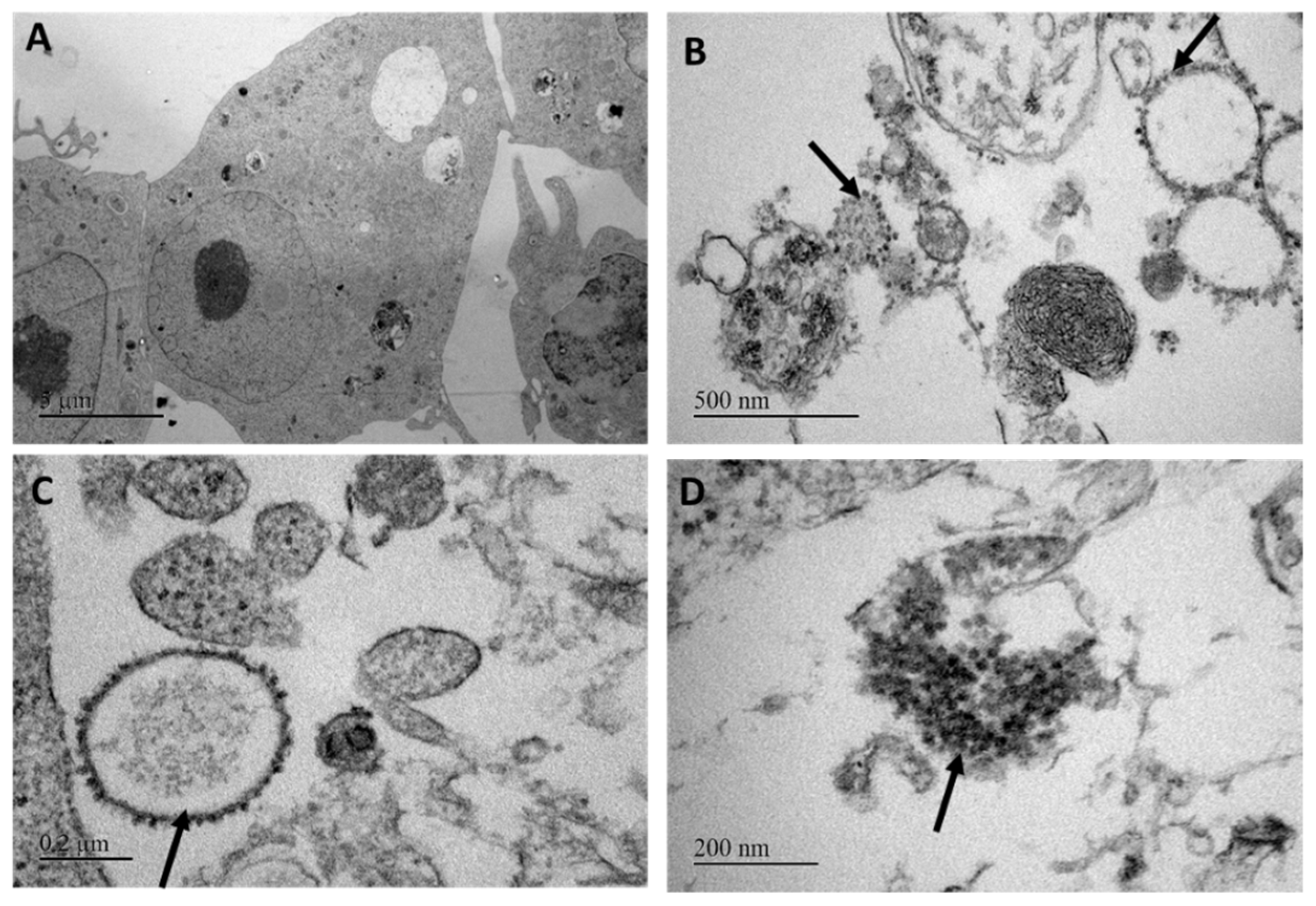 Viruses | free full-text | characterization of a new toti-like virus in