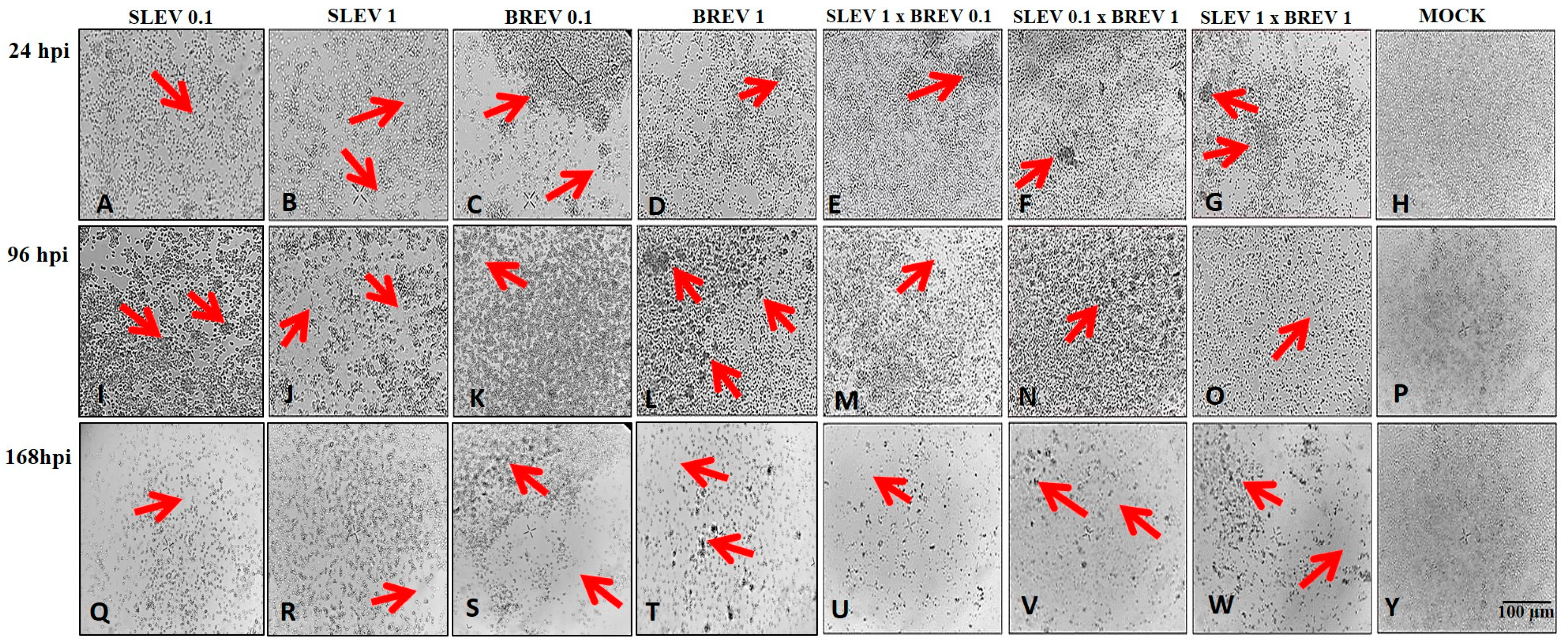 Viruses 16 00210 g001 Viruses 16 00210 g001