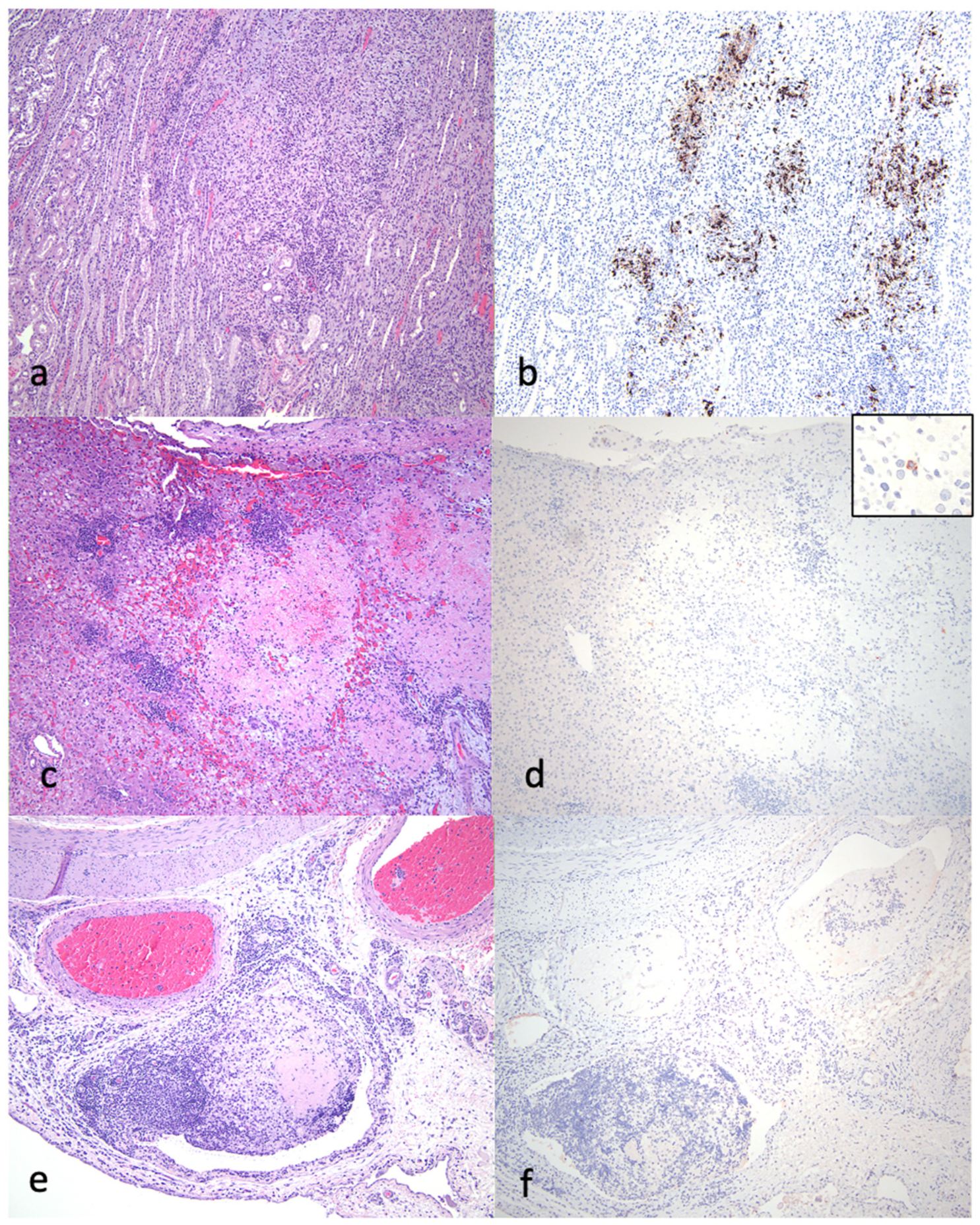 Viruses 16 00462 g006