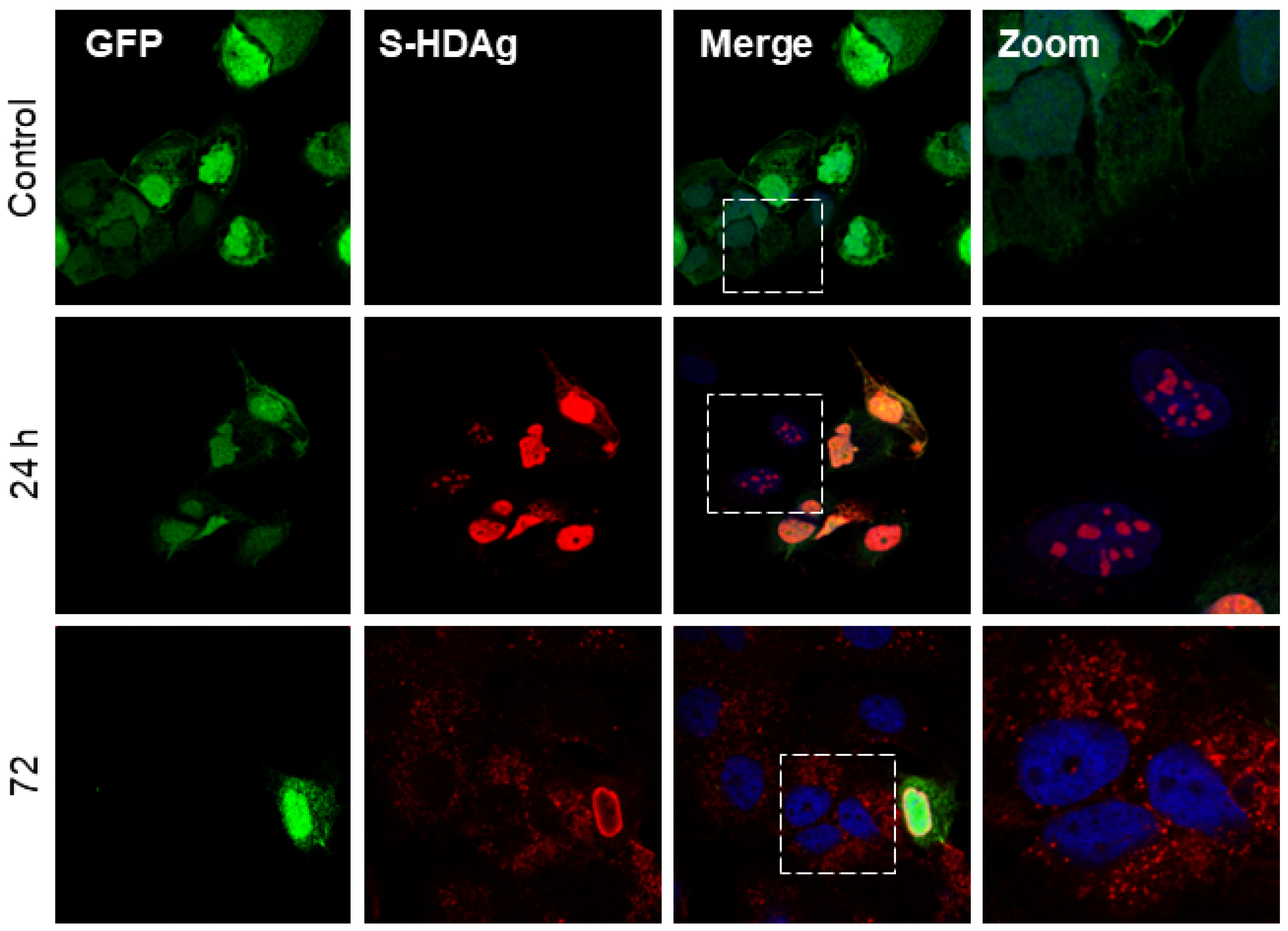 Viruses 16 00825 g002