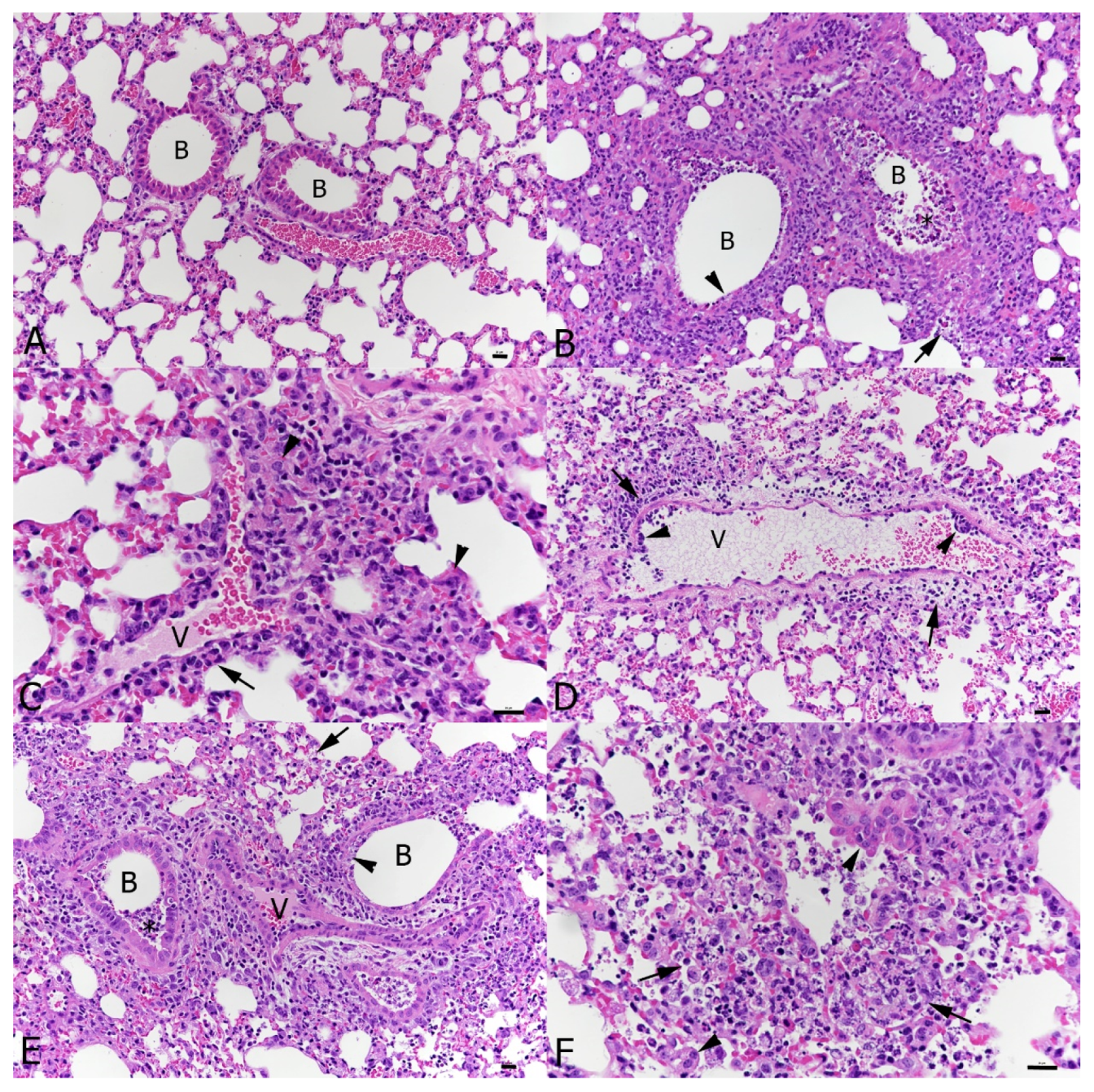 Viruses 16 00863 g004