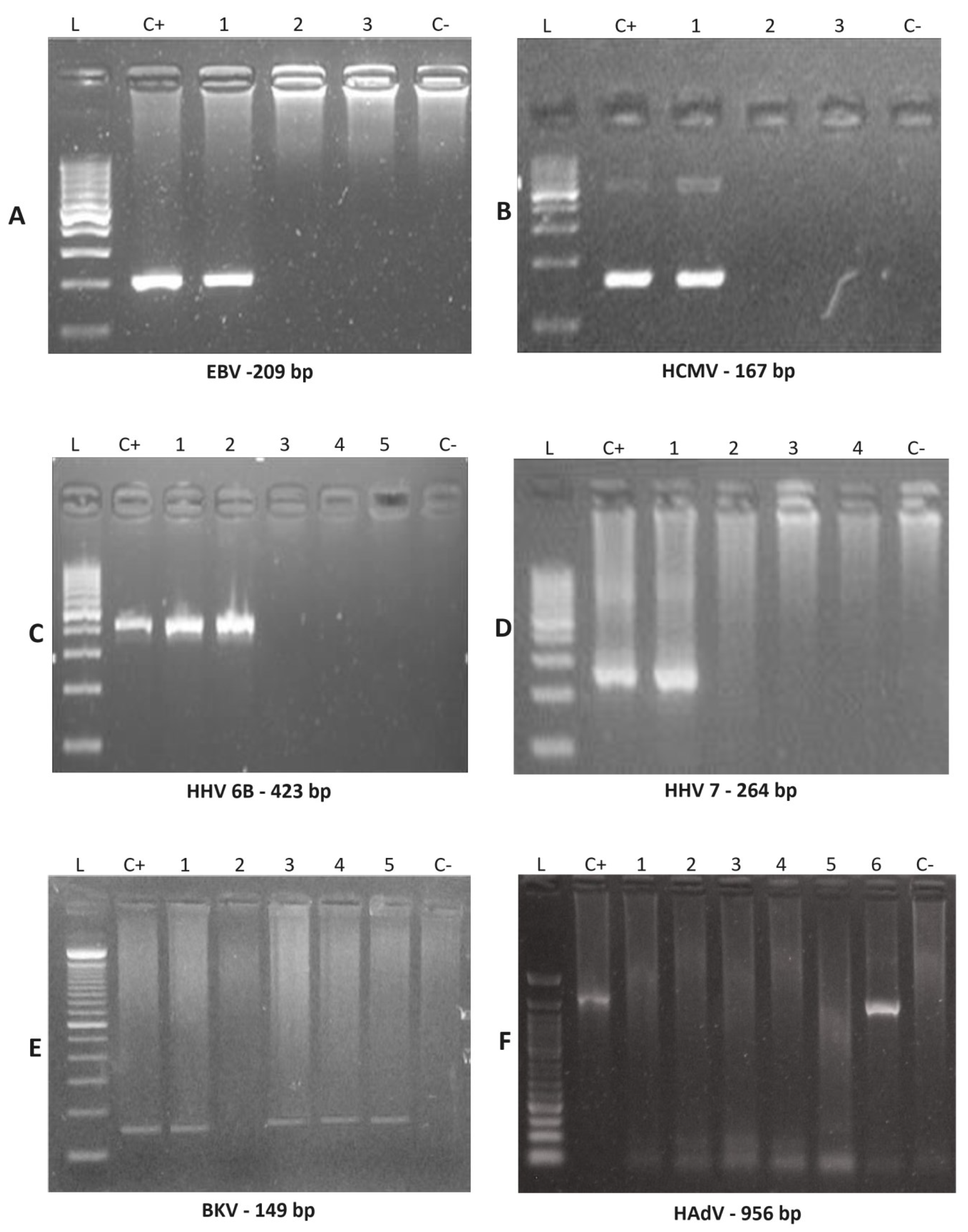 Viruses 16 01017 g001