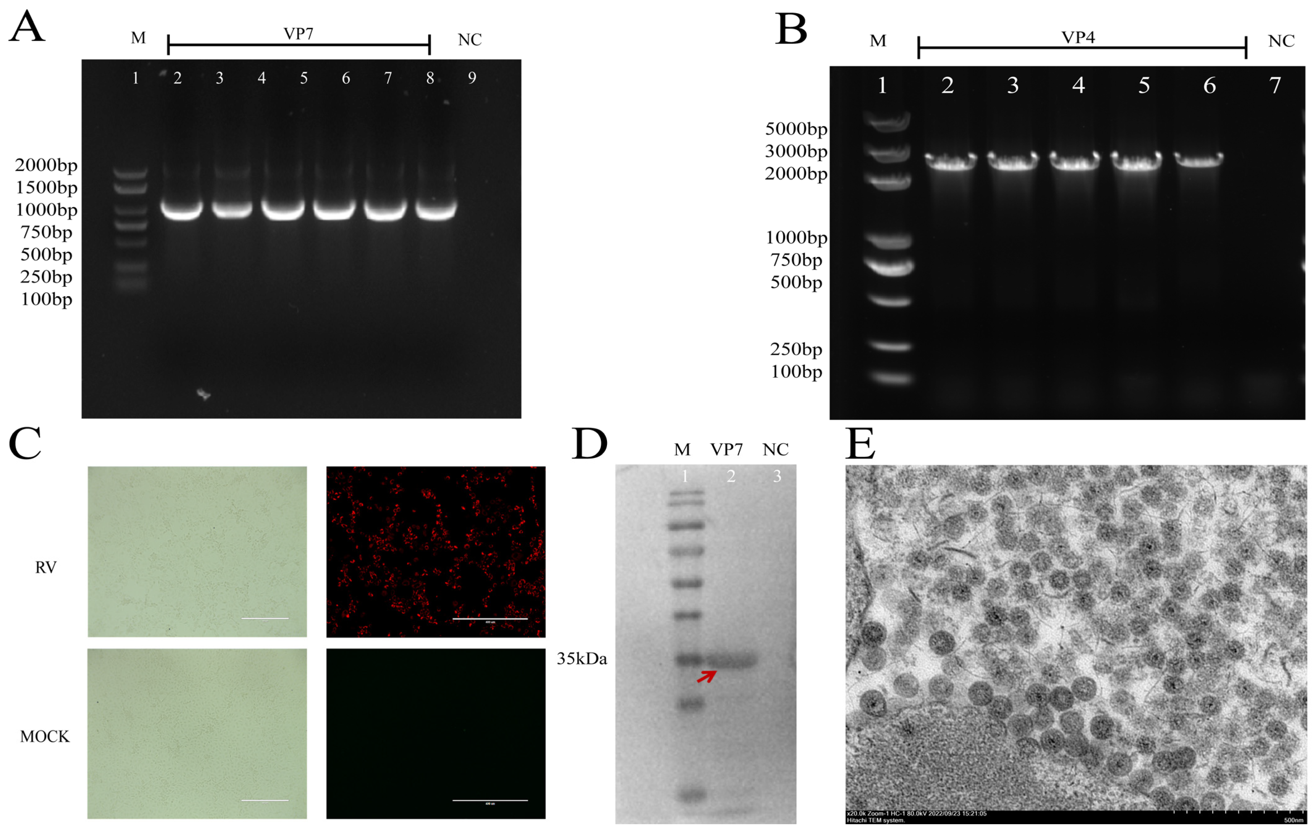 Viruses 16 01842 g002