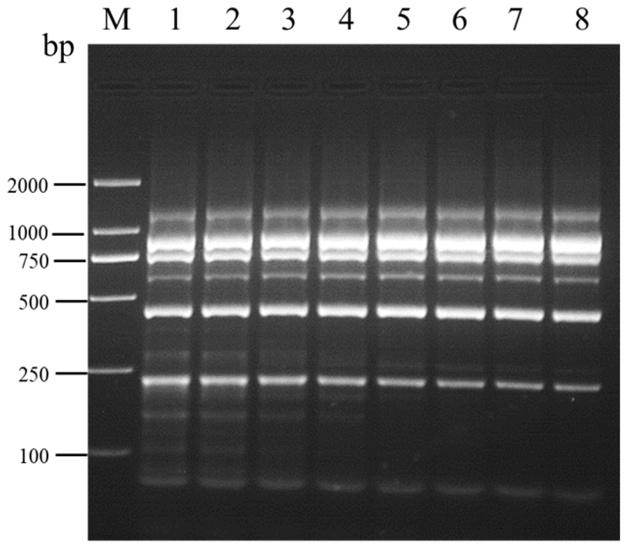 Coptisine inhibits neointimal hyperplasia through