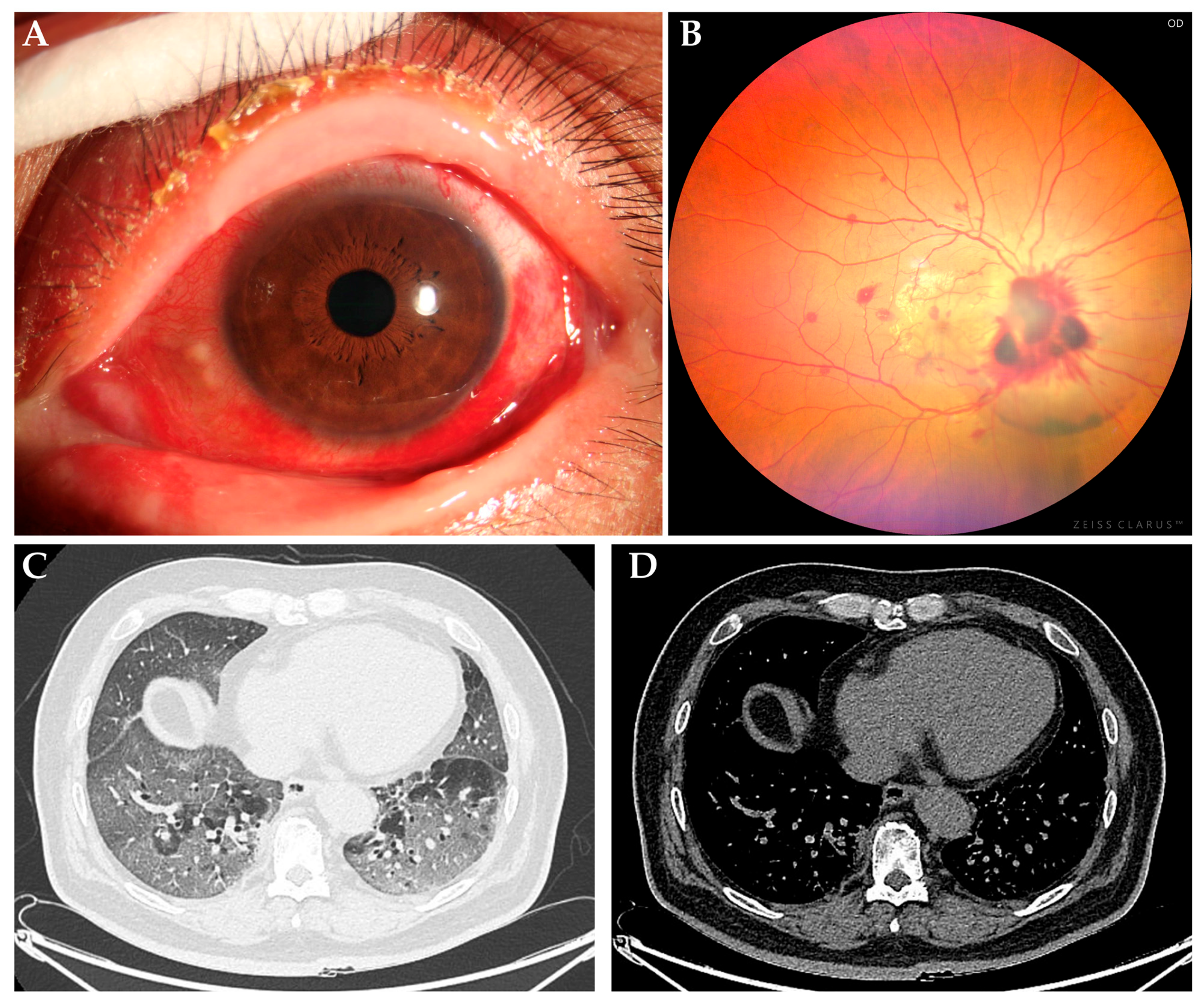 Viruses 17 00068 g001