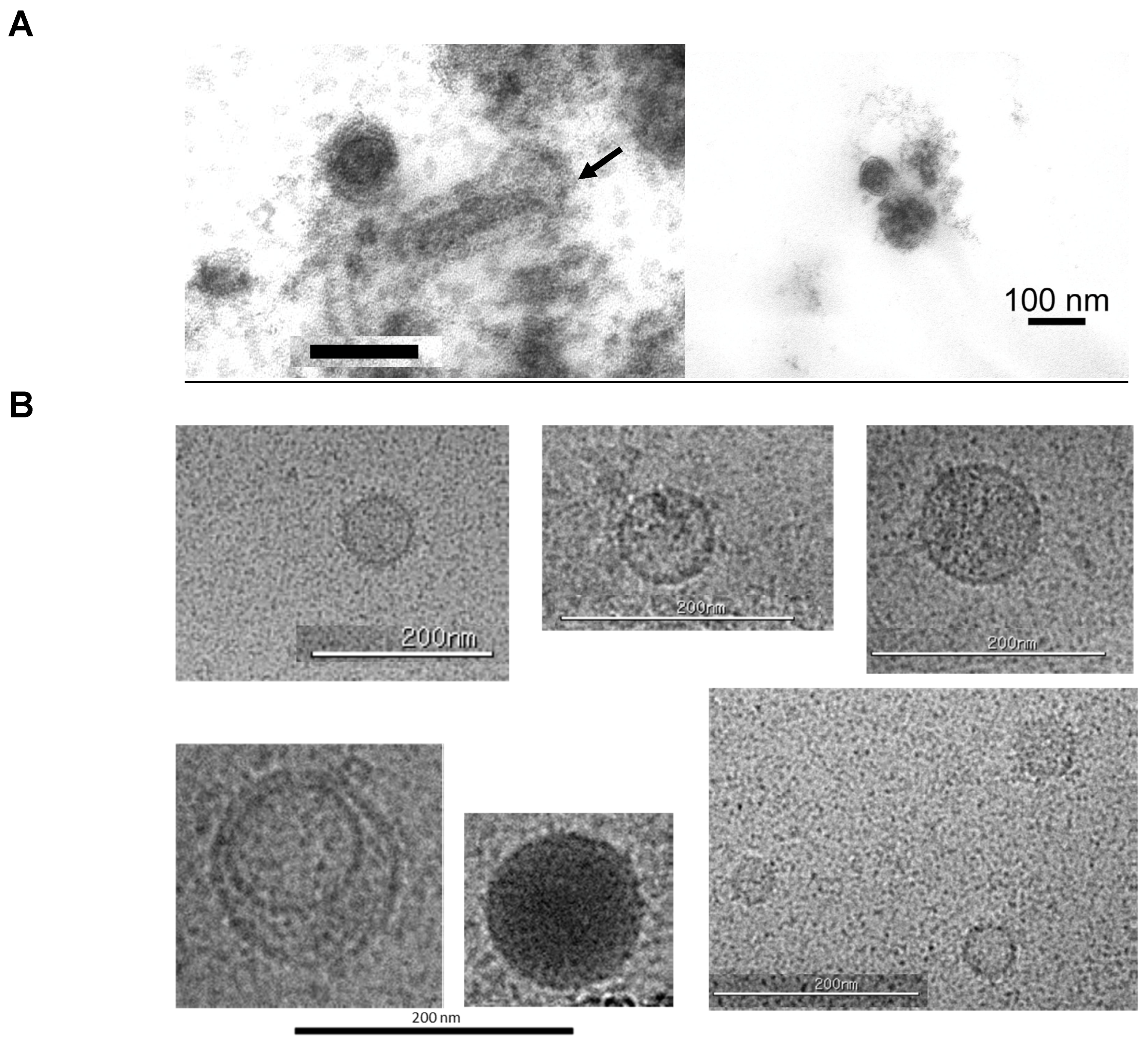 Viruses 17 00136 g004 Viruses 17 00136 g004