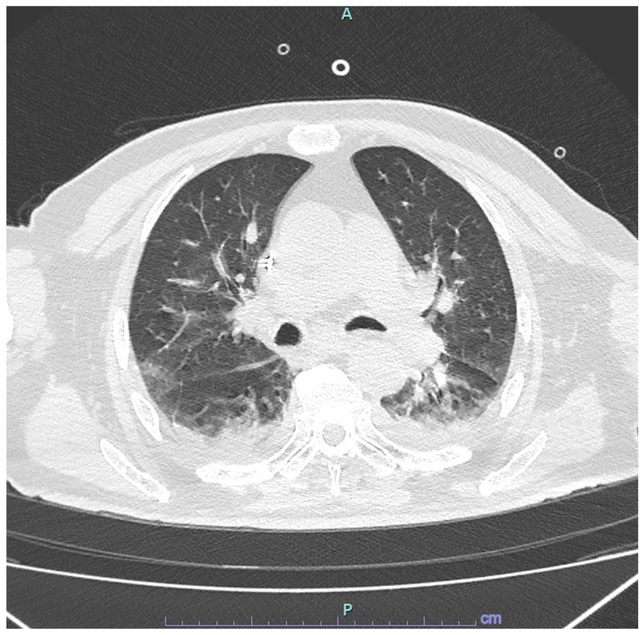 Viruses 17 00289 g001