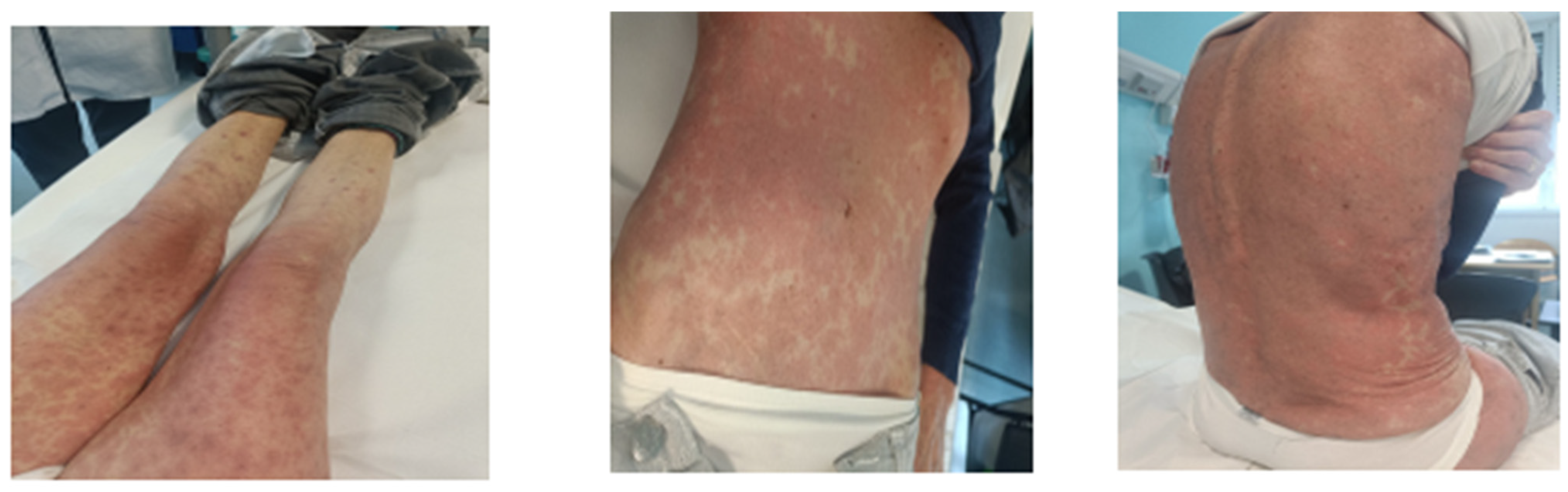 Viruses 17 00368 g001