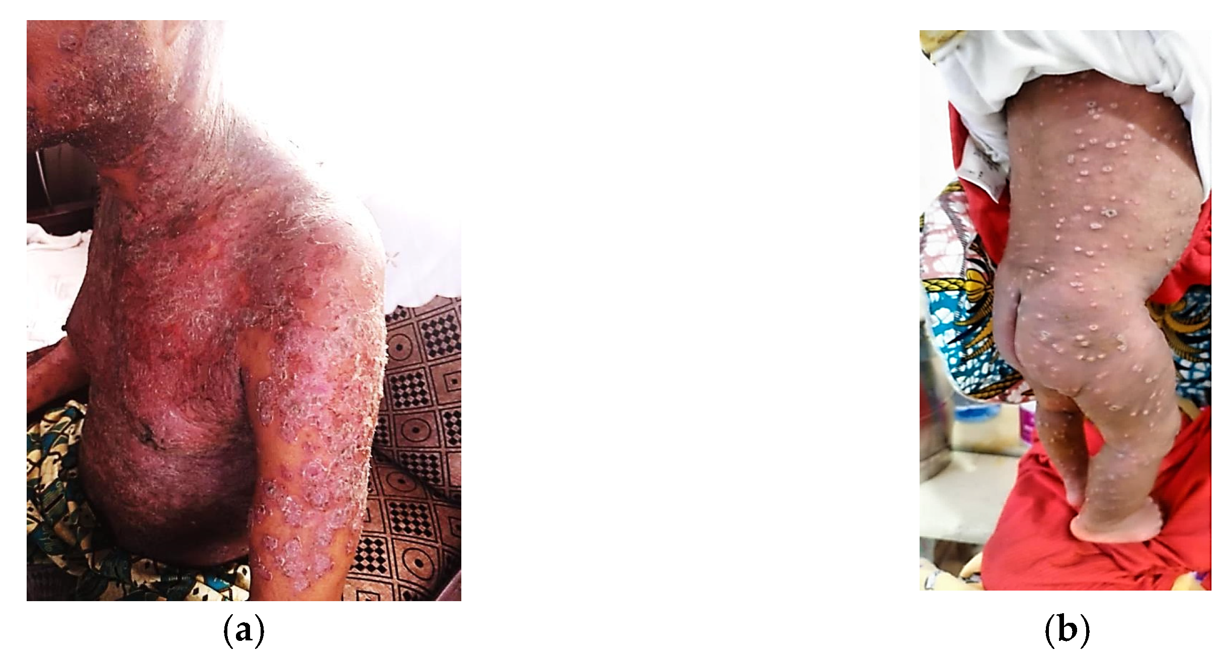 Viruses 17 00480 g001