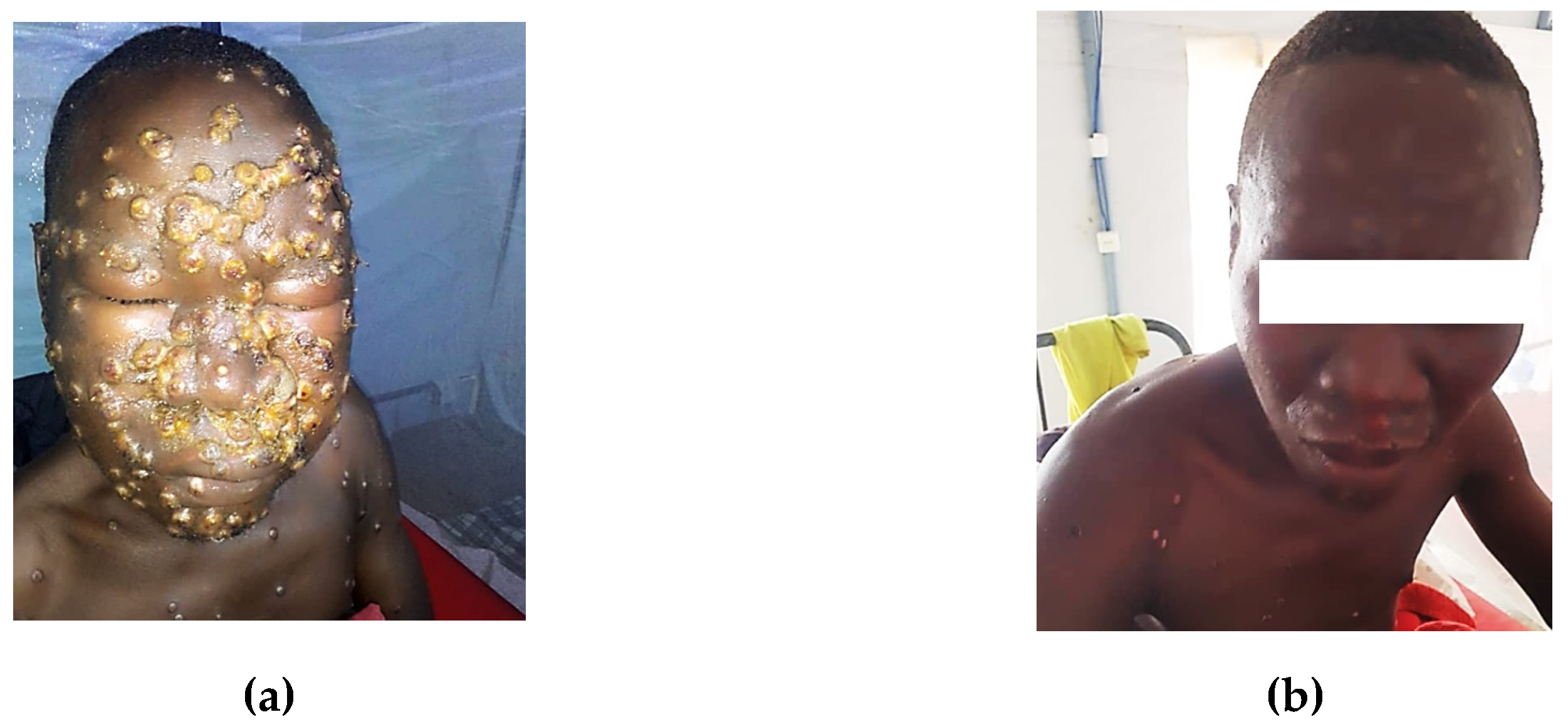 Viruses 17 00480 g002