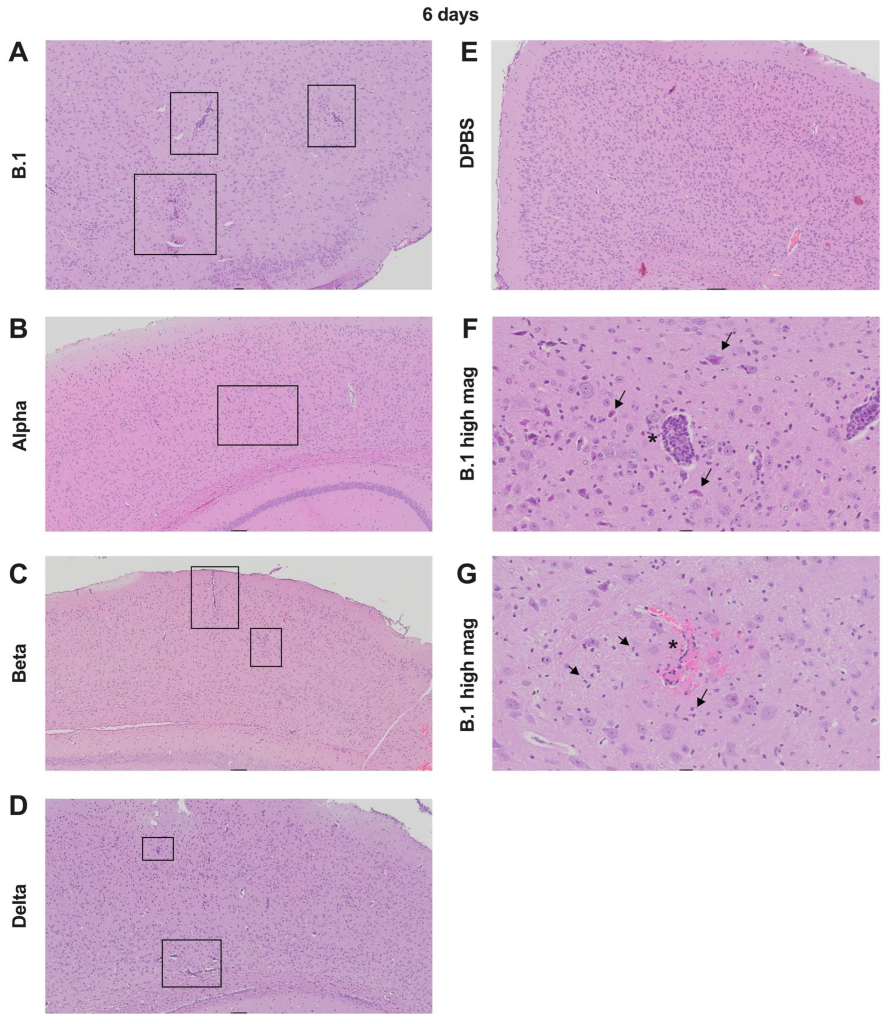Viruses 17 00500 g004