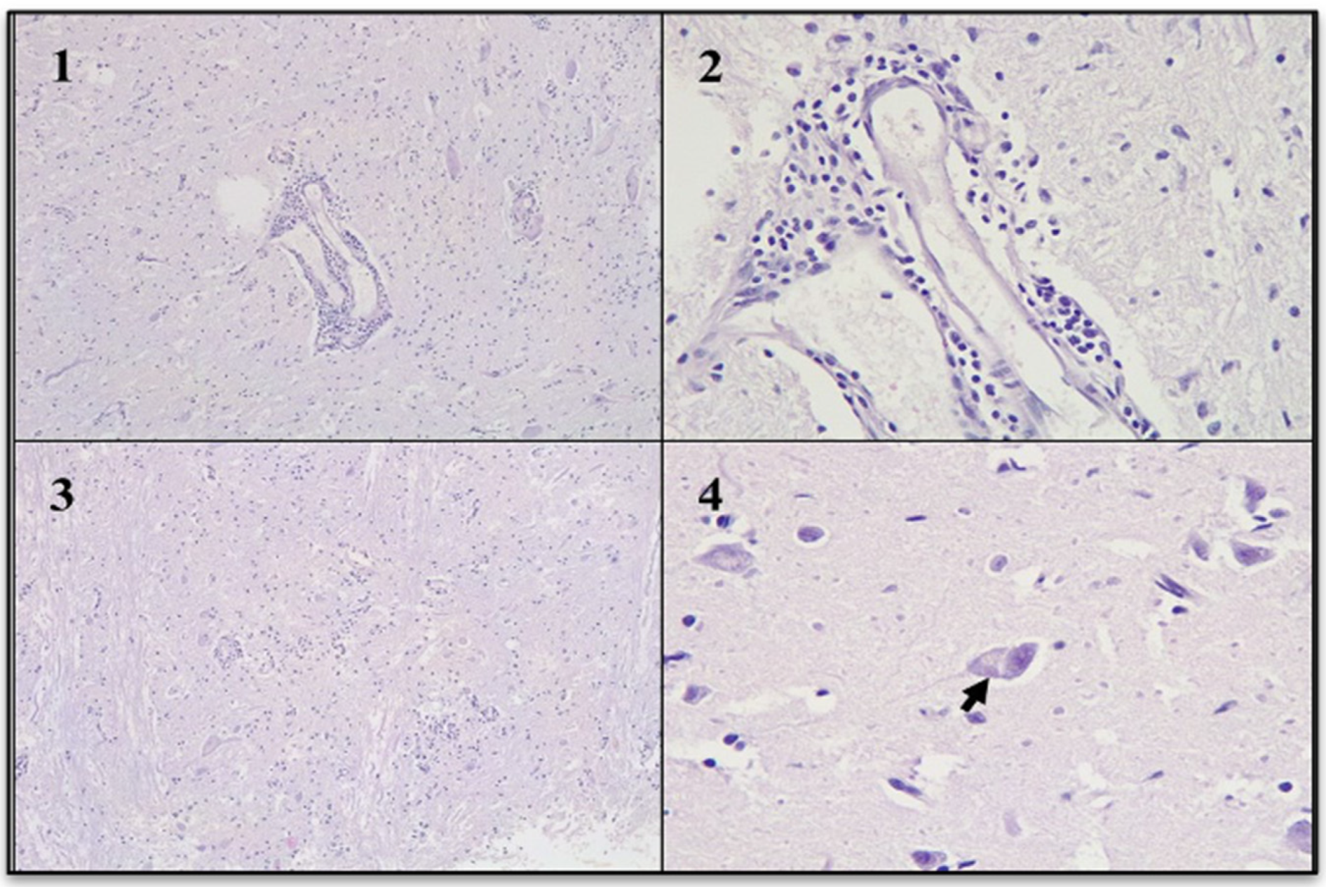 Viruses 17 00570 g005