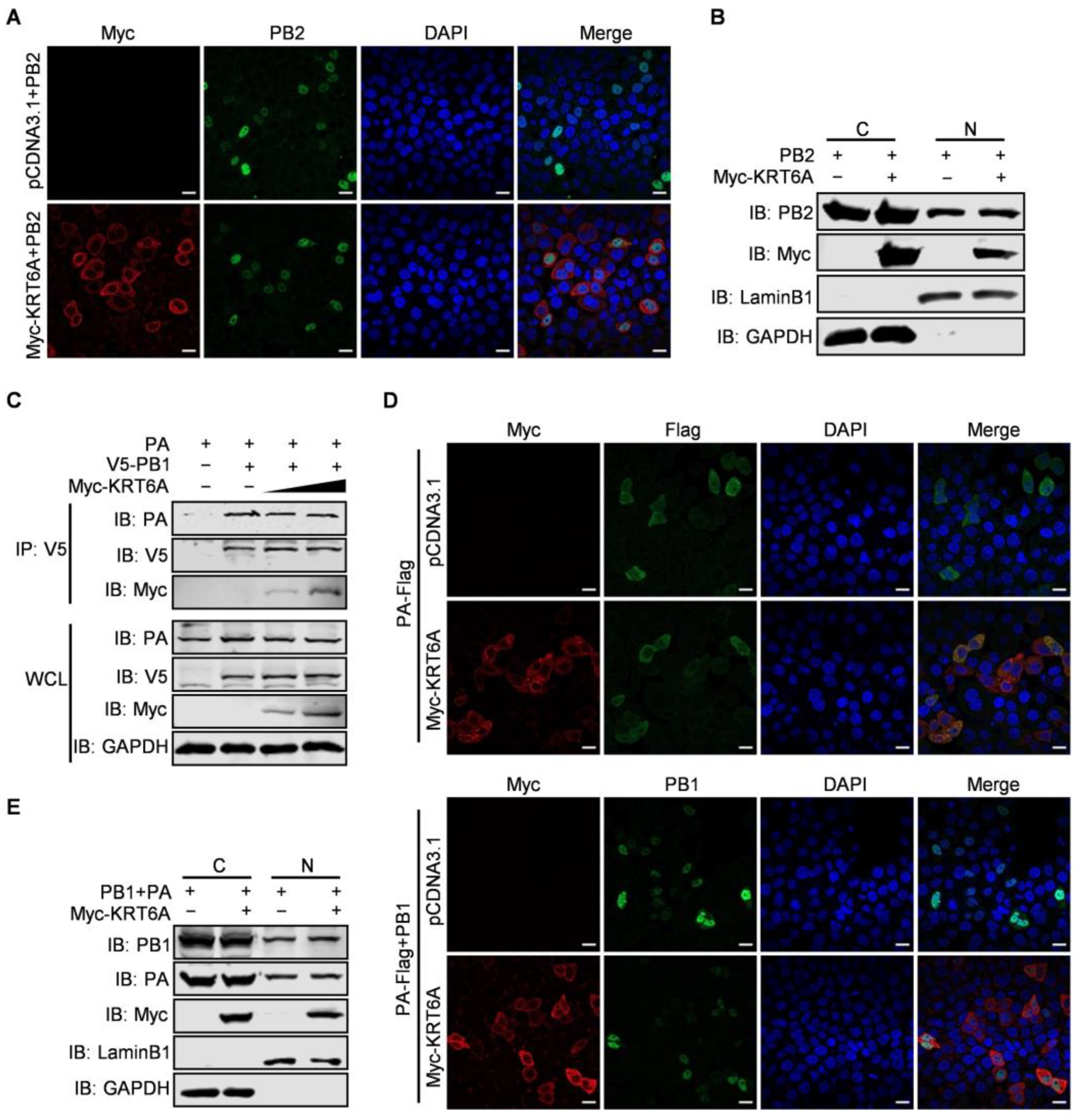 KRT6A Restricts Influenza A Virus Replication by Inhibiting