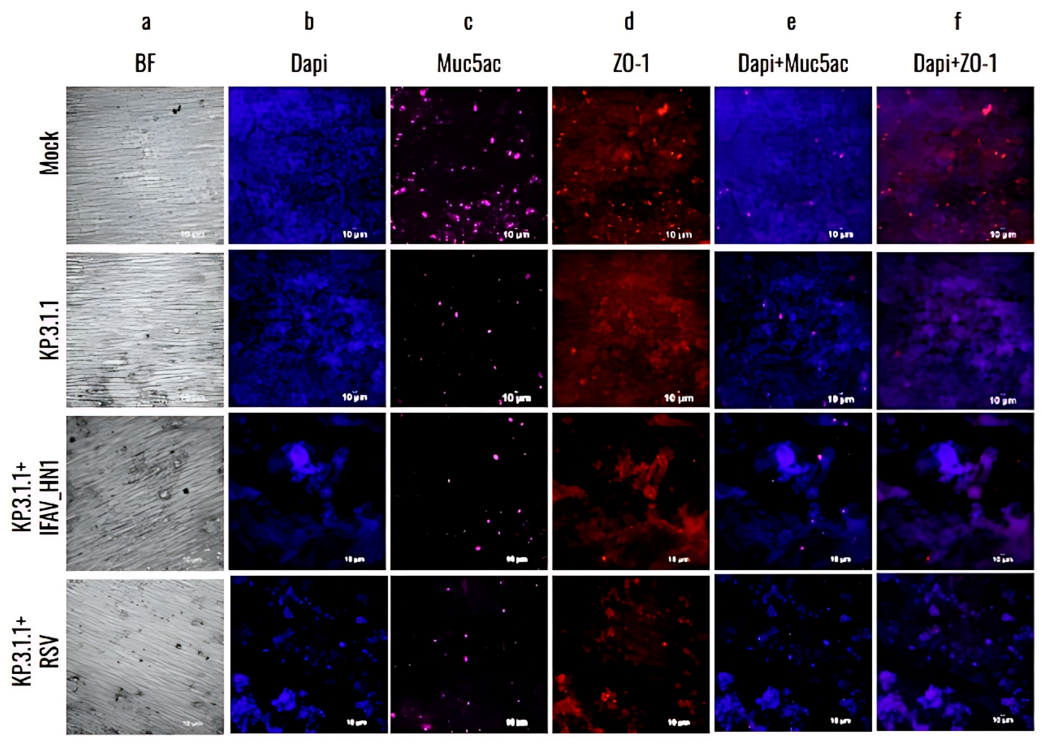Viruses 17 00918 g010