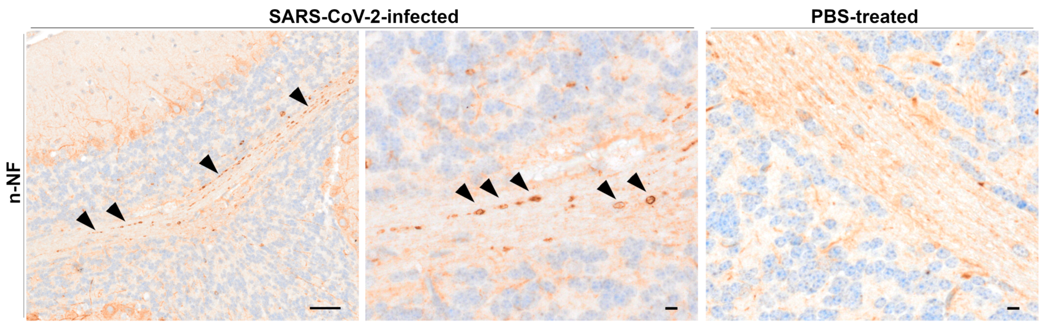Viruses 17 00963 g006