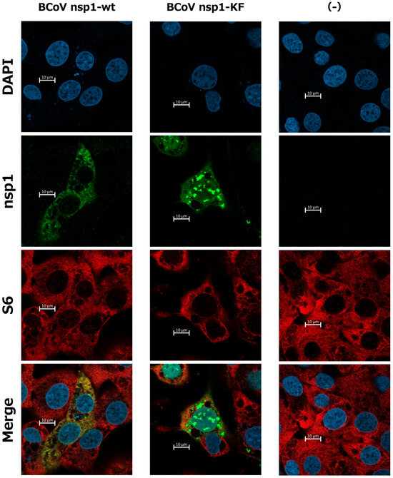 y Frontiers | Antiviral responses versus virus-induced