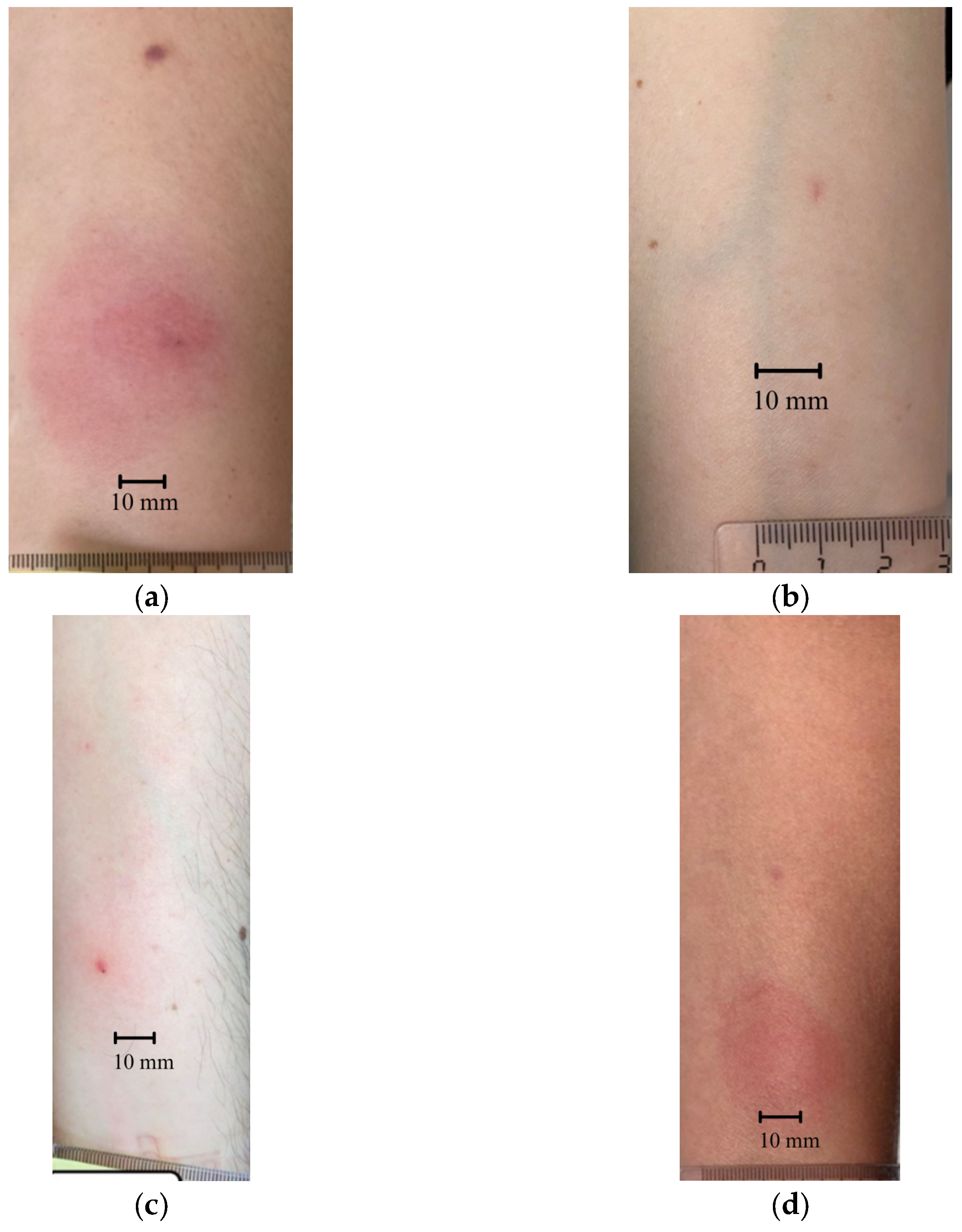 Viruses 17 01186 g004