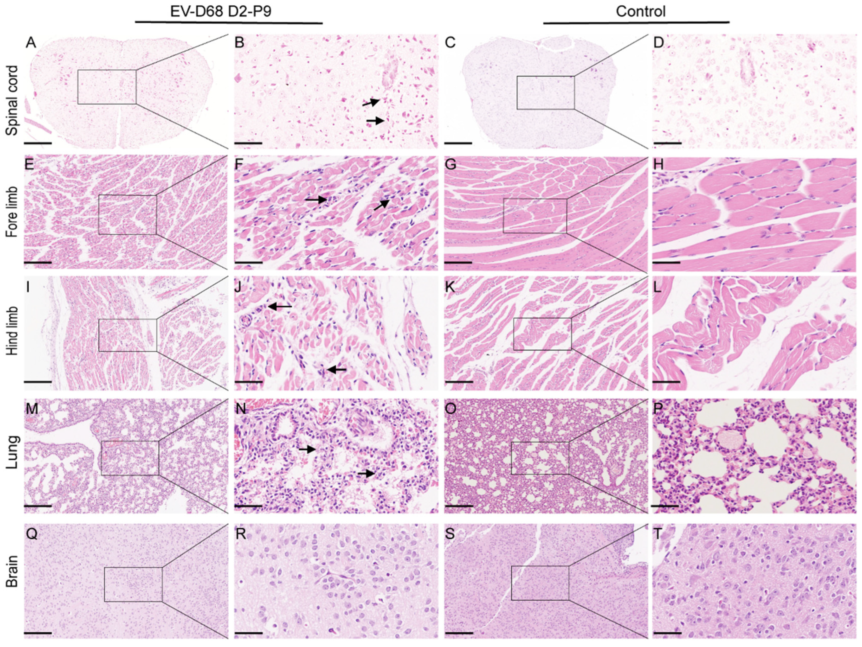 Viruses 17 01478 g003
