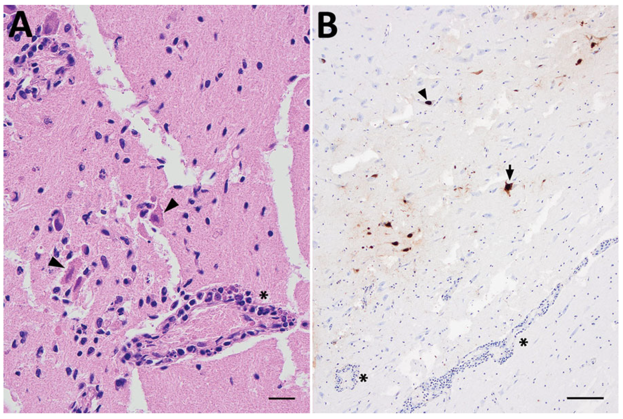 Viruses 17 01548 g008 Viruses 17 01548 g008