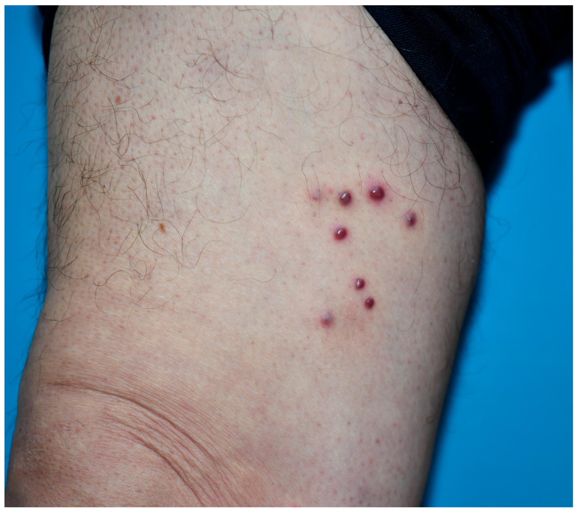 Viruses 18 00144 g001 Viruses 18 00144 g001