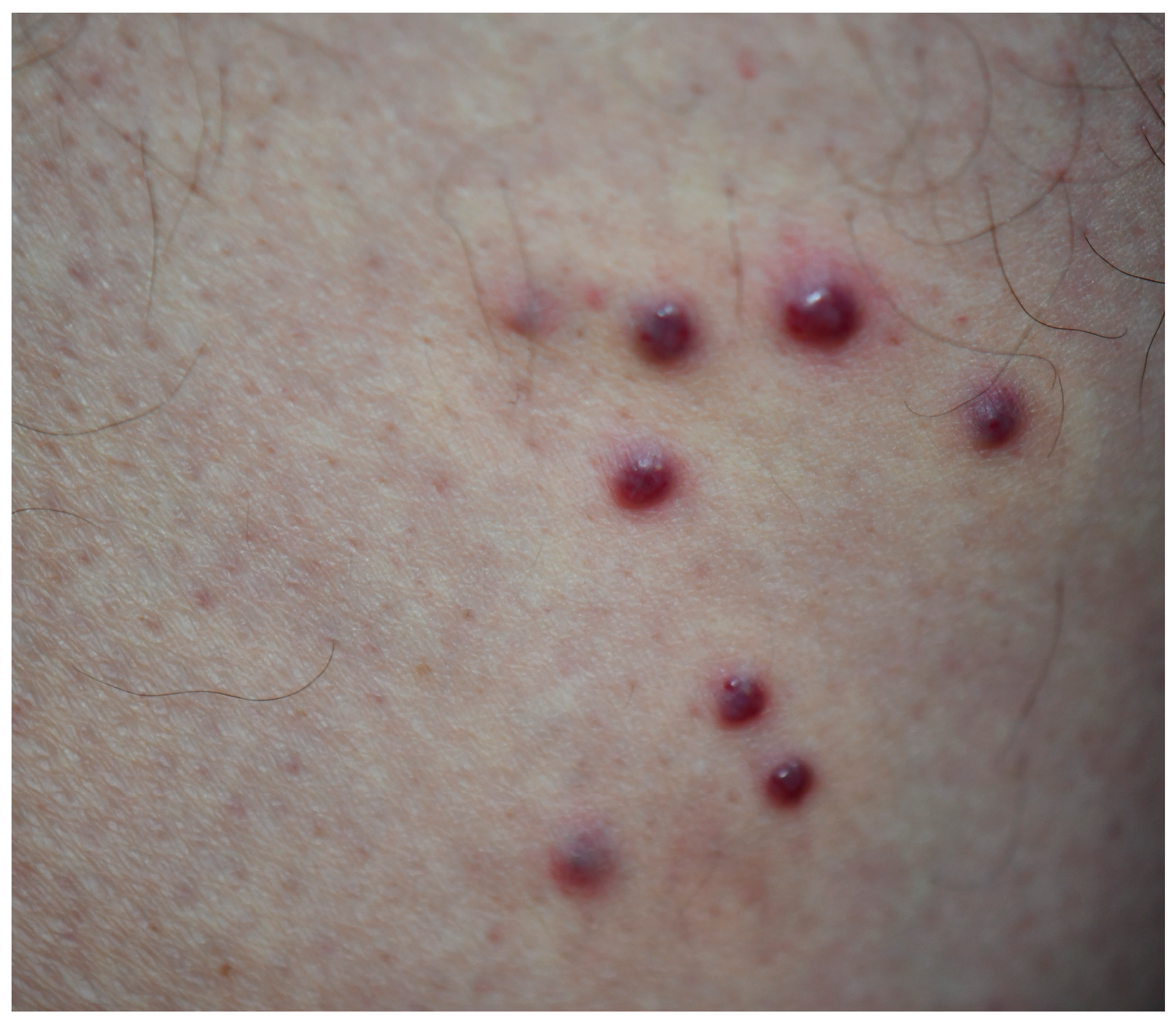 Viruses 18 00144 g002 Viruses 18 00144 g002