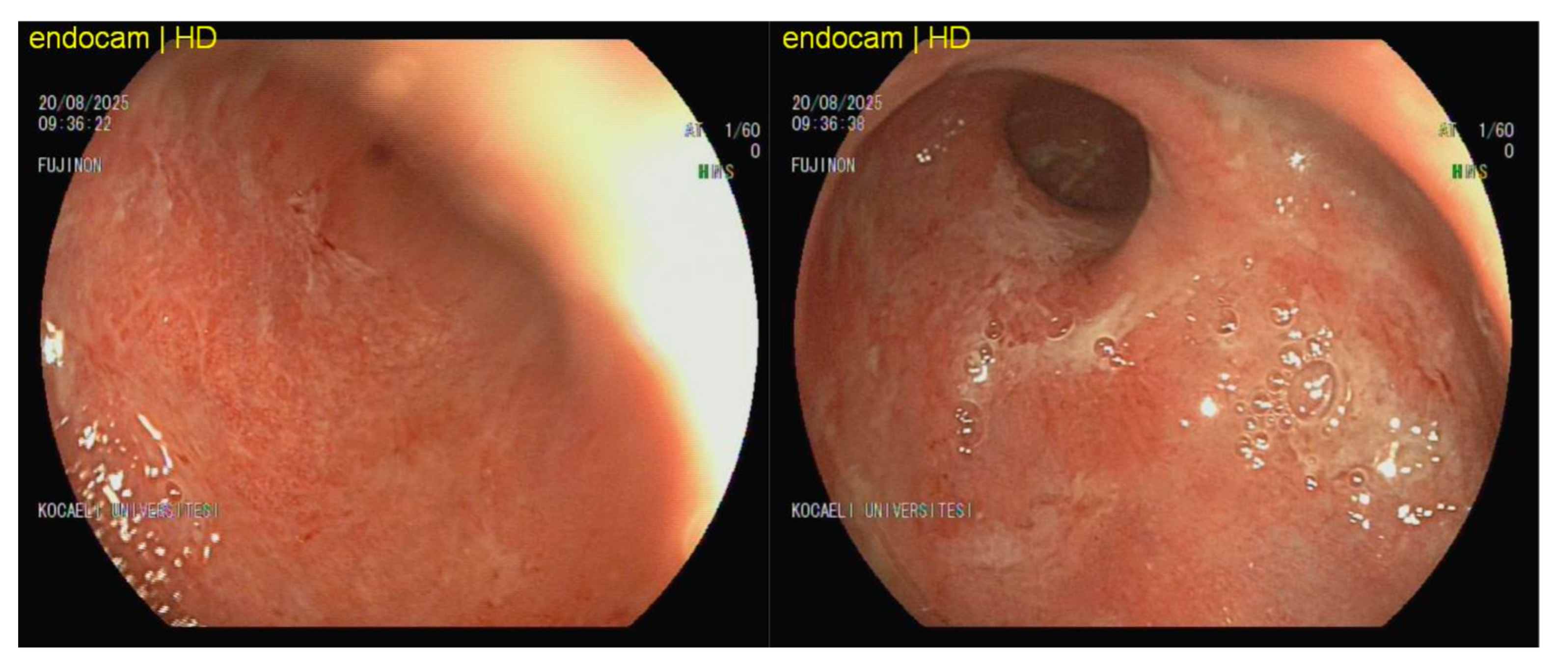 Viruses 18 00188 g002
