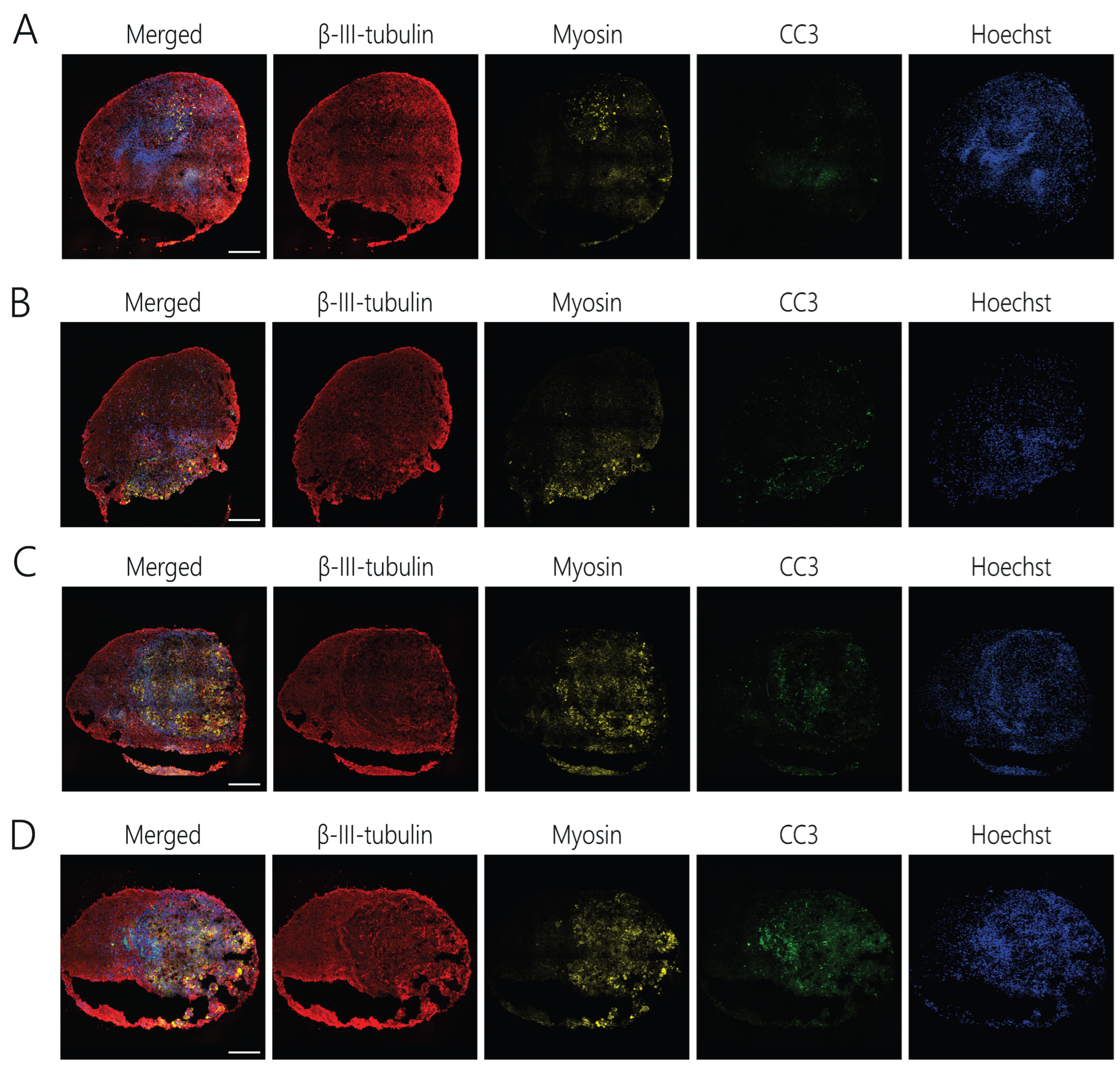Non-Polio Enterovirus A71 and D68 Infection of Human Neuromuscular