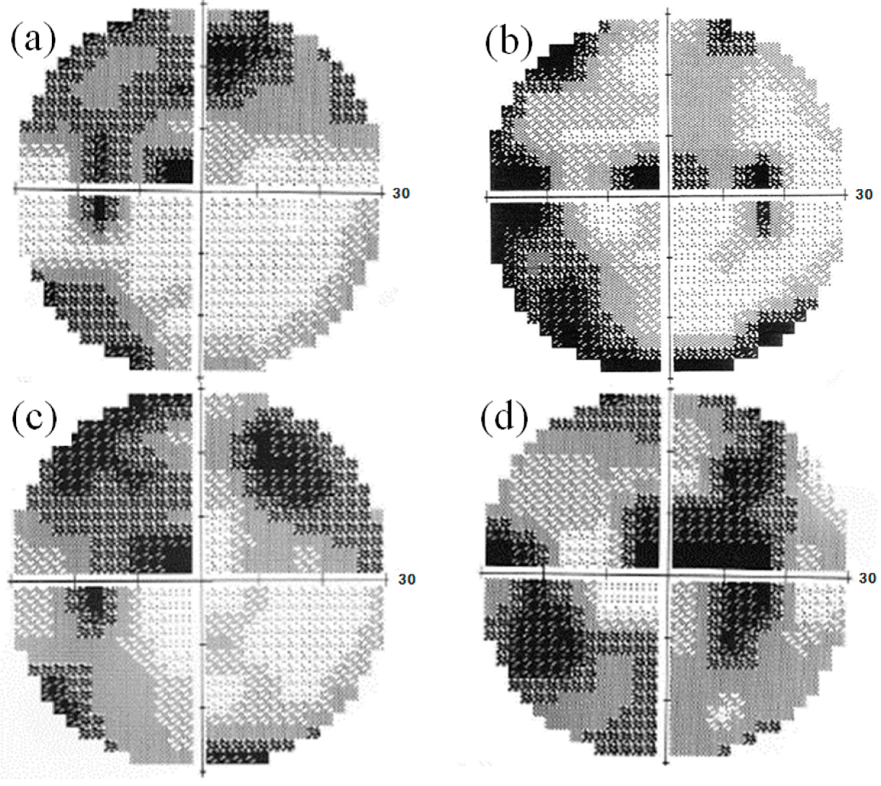 Vision 01 00005 g002