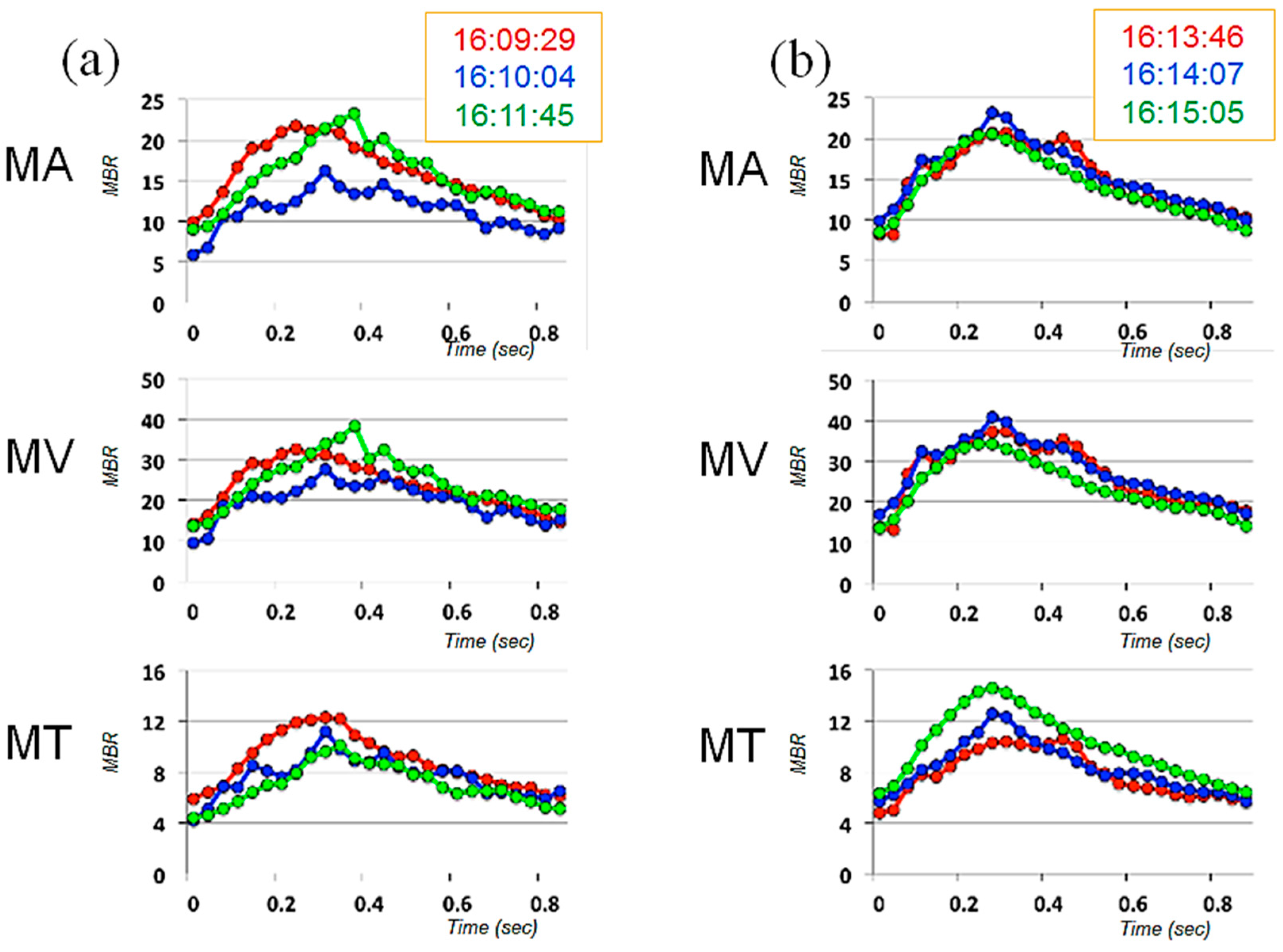 Vision 01 00005 g004
