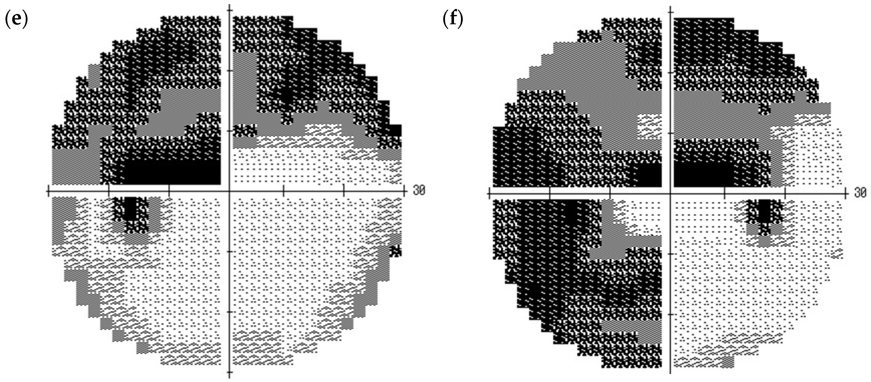 Vision 01 00005 g005b
